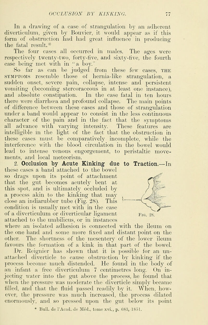 In a drawing of a case of strangulation by an adherent diverticuliun, given by Bouvier, it would appear as if this form of obstruction had had great influence in producing the fatal result.^ The four cases all occurred in males. The ages were respectively twenty-two, forty-live, and sixty-five, the fourth case being met with in a boy. So far as can be judged from these few cases, the SYMPTOMS resemble those of hernia-like strangulation, a sudden onset, severe pain, collapse, intense and persistent vomiting (becoming stercoraceous in at least one instance), and absolute constipation. In the case fatal in ten hours there were diarrhoea and profound collapse. The main points of difference between these cases and those of strangulation under a band would appear to consist in the less continuous character of the pain and in the fact that the symptoms all advance with varying intensity. These features are intelligible m the light of the fact that the obstruction in these cases must be comparatively incomplete, while the interference with the blood circulation in the bowel would lead to intense venous engorgement, to peristaltic move- ments, and local meteorism. 2. Occlusion by Acute Kinking due to Traction.—In these cases a band attached to the bowel so drags upon its point of attachment that the gut becomes acutely bent at this spot, and is ultimately occluded by a process akin to the kinking that may close an indiarubber tube (Fig. 28). This condition is usually met with in the case of a diverticulum or diverticular ligament Fig. 28? attached to the umbilicus, or in instances where an isolated adhesion is connected with the ileum on the one hand and some more fixed and distant point on the other. The shortness of the mesentery of the lower ileum favours the formation of a kink in that part of the bowel. Dr. Reignier has shown that it is possible for an un- attached diverticle to cause obstruction by kinking if the process become much distended. He found in the body of an infant a free diverticuluuL 7 centimetres long. On in- jecting water into the gut above the process, he found that when the pressure was moderate the diverticle simply became filled, and that the fluid passed readily by it. When, how- ever, the pressure was much increased, the process dilated enormously, and so j^ressed upon the gut below its point * Bull, de I'Acad. de Med., tome xvi., p. 683, 1851.
