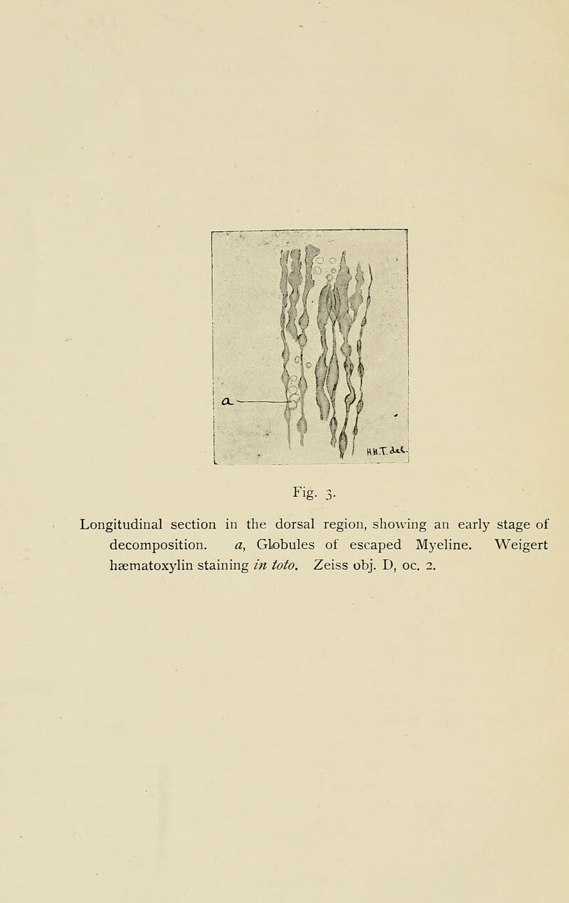 ■ 1' j nHT.a*<.- Fig. 3- Longitudinal section in tlie dorsal region, showing an early stage of decomposition. a, Globules of escaped Myeline, Weigert haematoxylin staining in toto. Zeiss obj. D, oc. 2.