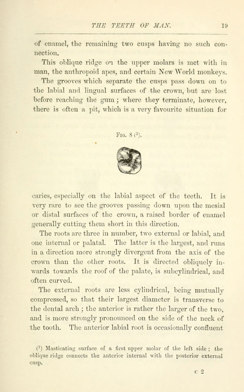of enamel, the remaining two cus^^s having no such con- nection. This oblique ridge on the upper molars is met with in man, the anthropoid apes, and certain New World monkeys. The grooves which separate the cusps pass down on to the labial and lingual surfaces of the crown, but are lost before reaching the gum; where they terminate, however, there is often a pit, which is a very favourite situation for Fig. 8 (i). caries, especially on the labial aspect of the teeth. It ia very rare to see the grooves passing down upon the mesial or distal surfaces of the crown, a raised border of enamel generally cutting them short in this direction. The roots are three in number, two external or labial, and one internal or palatal. The latter is the largest, and runs in a direction more strongly divergent from the axis of the crown than the other roots. It is directed obliquely in- wards towards the roof of the palate, is subcylindrical, and often curved. The external roots are less cylindrical, being mutually compressed, so that their largest diameter is transverse to the dental arch ; the anterior is rather the larger of the two, and is more strongly pronounced on the side of the neck of the tooth. The anterior labial root is occasionally confluent (^) Masticating surface of a first upper molar of the left side ; the oblique ridge connects the anterior internal with the posterior external cusp.