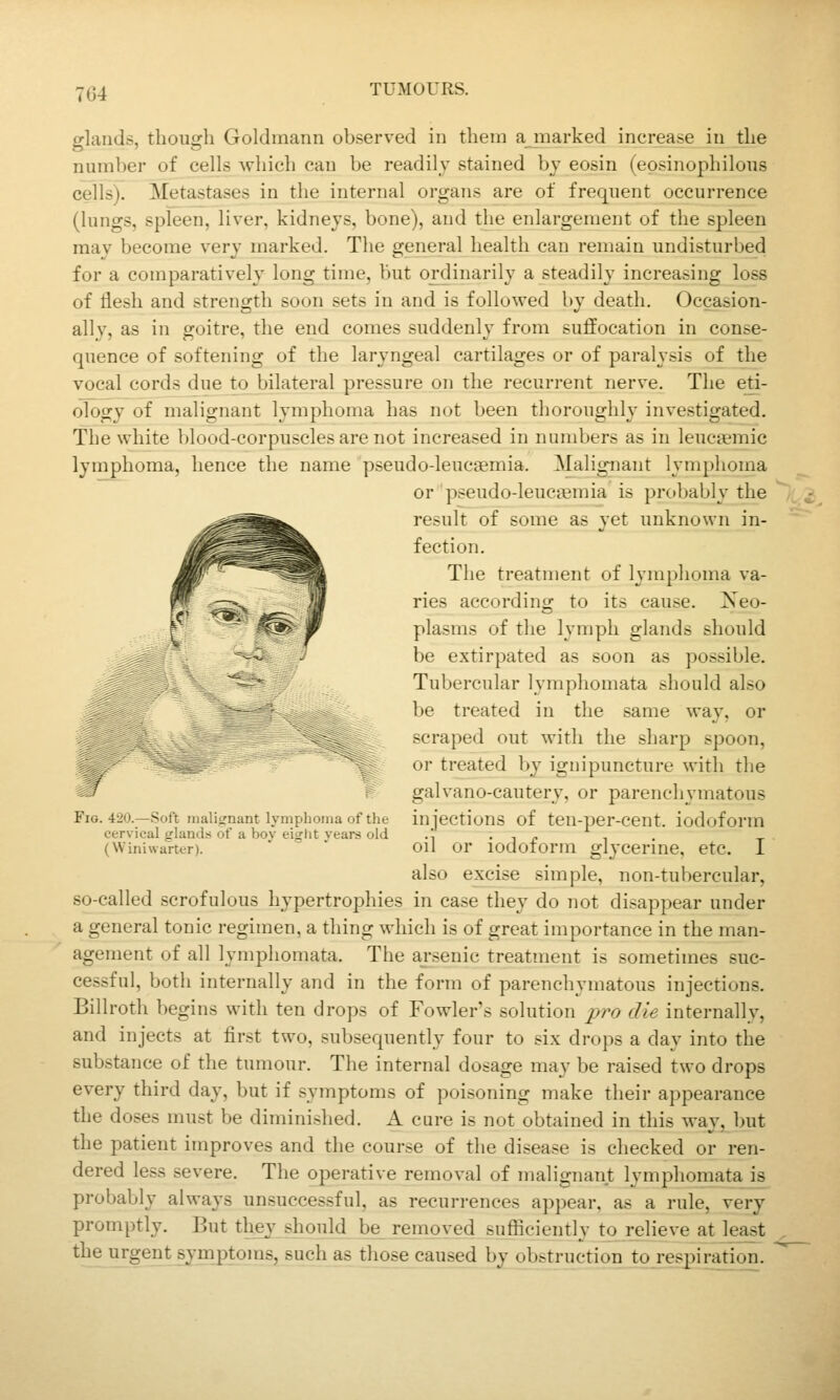 7G4 glands, though Goldraann observed in them ajnarked increase in the numl)er of cells which can be readily stained by eosin (eosinophilons cells). Metastases in the internal organs are of frequent occurrence (lungs, spleen, liver, kidneys, bone), and the enlargement of the spleen may become very marked. The general health can remain undisturbed for a comparatively long time, but ordinarily a steadily increasing loss of flesh and strength soon sets in and is followed by death. Occasion- all v, as in goitre, the end comes suddenly from suffocation in conse- quence of softening of the laryngeal cartilages or of paralysis of the vocal cords due to bilateral pressure on the recurrent nerve. The ed- ology of malignant lymphoma has not been thoroughly investigated. The white blood-corpuscles are not increased in numbers as in leuca^mic lymphoma, hence the name pseudo-leucaemia. Malignant lymphoma or pseudo-leucaemia is probably the result of some as yet unknown in- fection. The treatment of lymphoma va- ries according to its cause. Neo- plasms of the lymph glands should be extirpated as soon as possible. Tubercular lymphomata should also be treated in the same way, or scraped out with the sharp spoon, or treated by ignipuncture with the galvano-cauterv, or parenchymatous injections of ten-per-cent. iodoform oil or iodoform glycerine, etc. I also excise simple, non-tubercular, so-called scrofulous hypertrophies in case they do not disappear under a general tonic regimen, a thing which is of great importance in the man- agement of all lymphomata. The arsenic treatment is sometimes suc- cessful, both internally and in the form of parenchymatous injections. Billroth begins with ten drops of Fowler's solution pro die internally, and injects at first two, subsequently four to six drops a day into the substance of the tumour. The internal dosage may be raised two drops every third day, but if symptoms of poisoning make their appearance the doses must be diminished. A cure is not obtained in this wav, but the patient improves and the course of the disease is checked or ren- dered less severe. The operative removal of malignant lymphomata is probably always unsuccessful, as recurrences appear, as a rule, very promptly. But the}' should be removed sufficiently to relieve at least the urgent symptoms, such as those caused by obstruction to respiration. Fig. 420.—Soft malignant lymphoma of the cervical gland.s of a boy eight years old (Winiwarter).