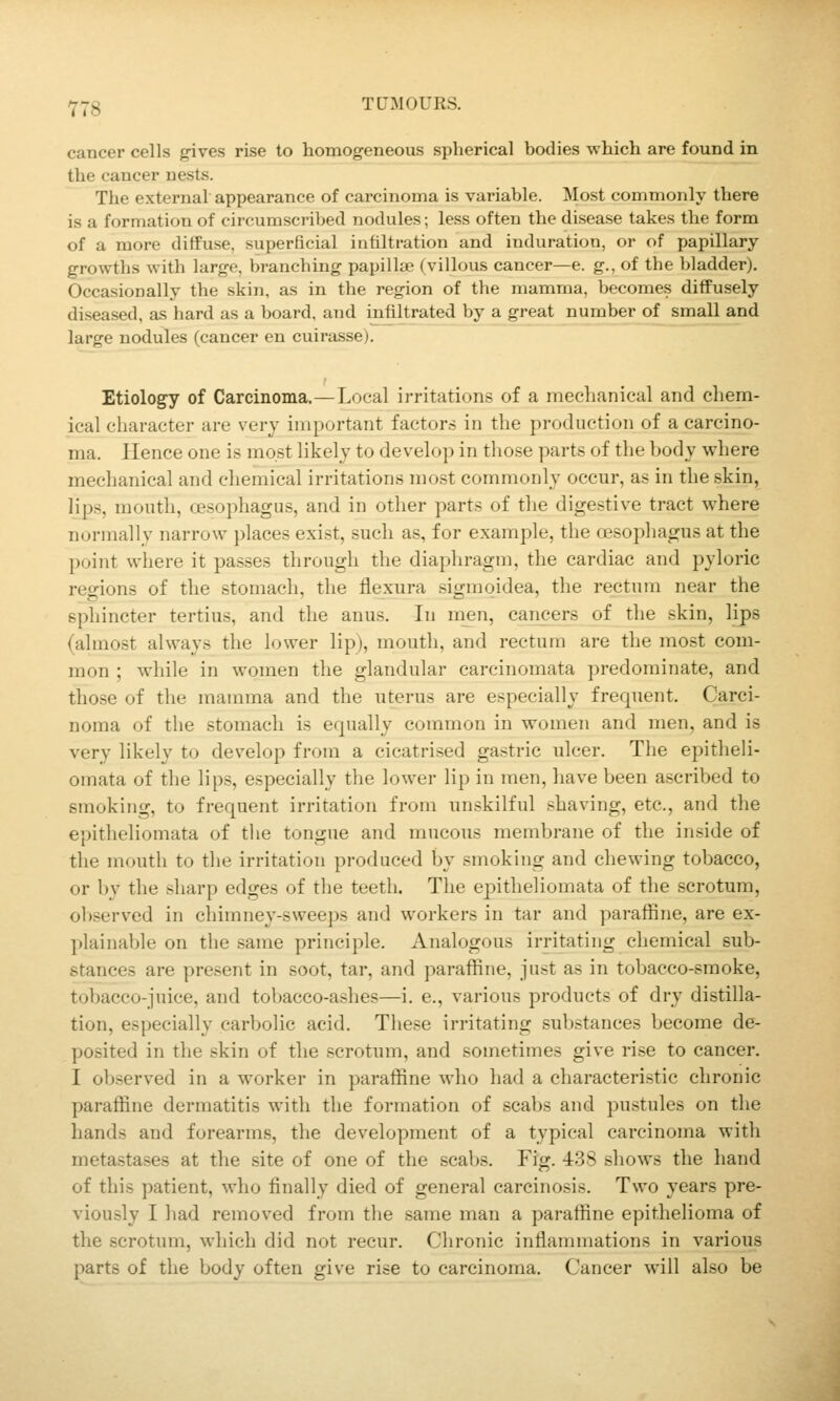 Y78 TCMOURS. cancer cells gives rise to homogeneous spherical bodies which are found in the cancer nests. The external appearance of carcinoma is variable. Most commonly there is a formation of circumscribed nodules; less often the disease takes the form of a more diffuse, superficial infiltration and induration, or of papillary- growths with large, branching papillae (villous cancer—e. g., of the bladder). Occasionally the skin, as in the region of the mamma, becomes diffusely diseased, as hard as a board, and infiltrated by a great number of small and large nodules (cancer en cuirasse). Etiology of Carcinoma.—Local irritations of a mechanical and chem- ical character are very important factors in the production of a carcino- ma. Hence one is most likely to develop in those parts of the body wliere mechanical and chemical irritations most commonly occur, as in the skin, lips, mouth, oesophagus, and in other parts of the digestive tract where normally narrow places exist, such as, for example, the cjesophagus at the point where it passes through the diaphragm, the cardiac and pyloric regions of the stomach, the flexura sigmqidea, the rectum near the sphincter tertius, and the anus. In nien, cancers of the skin, lips (almost always the lower lip), mouth, and rectum are the most com- mon ; while in women the glandular carcinomata predominate, and those of the mamma and the uterus are especially frequent. Carci- noma of the stomach is equally common in women and men, and is very likely to develop from a cicatrised gastric ulcer. The epitheli- omata of the lips, especially the lower lip in men, have been ascribed to smoking, to frequent irritation from unskilful shaving, etc., and the epitheliomata of the tongue and mucous membrane of the inside of the mouth to the irritation produced by smoking and chewing tobacco, or by the sharp edges of the teeth. The epitheliomata of the scrotum, observed in cliimney-sweeps and workers in tar and paraffine, are ex- plainable on the same principle. Analogous irritating chemical sub- stances are present in soot, tar, and paraffine, just as in tobacco-smoke, tobacco-juice, and tobacco-ashes—i. e., various products of dry distilla- tion, especially carbolic acid. These irritating substances become de- posited in the skin of the scrotum, and sometimes give rise to cancer. I observed in a worker in paraffine who had a characteristic chronic paraffine dermatitis with the formation of scabs and pustules on the hands and forearms, the development of a typical carcinoma with metastases at the site of one of the scabs. Fig. 438 shows the hand of this patient, who finally died of general carcinosis. Two years pre- viously I had removed from the same man a paraffine epithelioma of the scrotum, which did not recur. Chronic inflammations in various parts of the body often give rise to carcinoma. Cancer will also be
