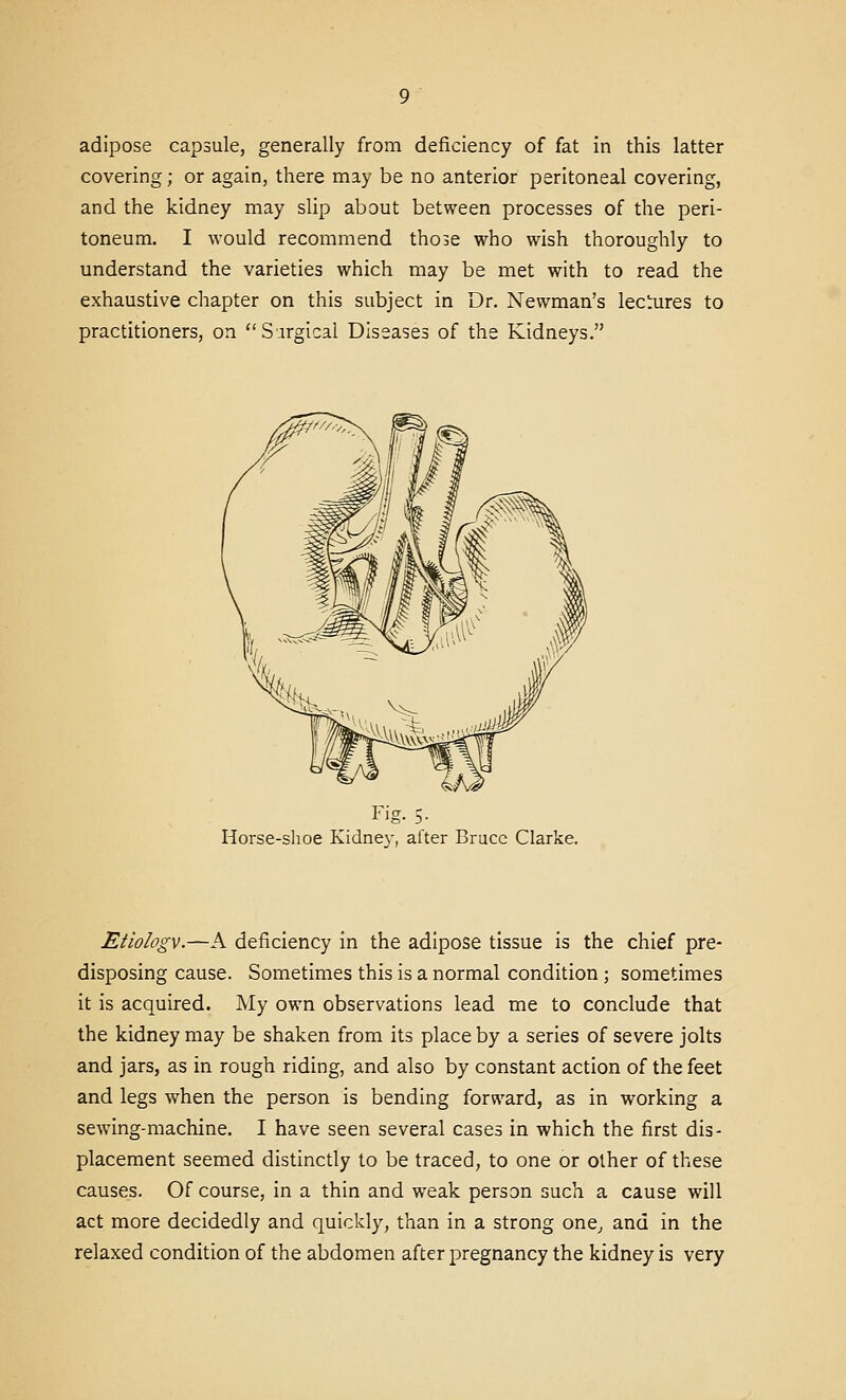 adipose capsule, generally from deficiency of fat in this latter covering; or again, there may be no anterior peritoneal covering, and the kidney may slip about between processes of the peri- toneum. I would recommend those who wish thoroughly to understand the varieties which may be met with to read the exhaustive chapter on this subject in Dr. Newman's lectures to practitioners, on S.irgical Diseases of the Kidneys. Fig. 5- Horse-shoe Kidnev, after Bruce Clarke. Etiologv.—A deficiency in the adipose tissue is the chief pre- disposing cause. Sometimes this is a normal condition; sometimes it is acquired. My own observations lead me to conclude that the kidney may be shaken from its place by a series of severe jolts and jars, as in rough riding, and also by constant action of the feet and legs when the person is bending forward, as in working a sewing-machine. I have seen several cases in which the first dis- placement seemed distinctly to be traced, to one or other of these causes. Of course, in a thin and weak person such a cause will act more decidedly and quickly, than in a strong one, and in the relaxed condition of the abdomen after pregnancy the kidney is very