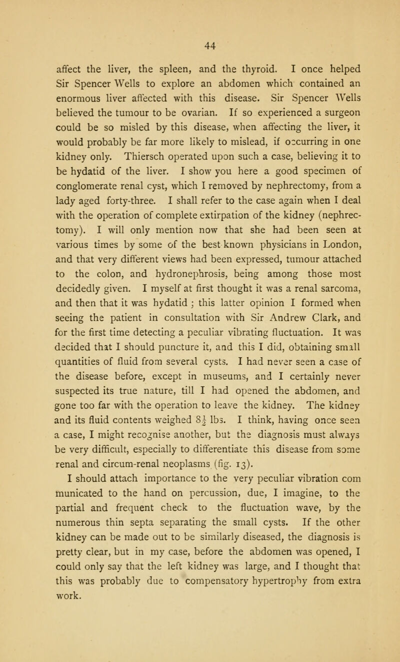 afifect the liver, the spleen, and the thyroid. I once helped Sir Spencer Wells to explore an abdomen which contained an enormous liver aftected with this disease. Sir Spencer Wells believed the tumour to be ovarian. If so experienced a surgeon could be so misled by this disease, when affecting the liver, it would probably be far more likely to mislead, if occurring in one kidney only. Thiersch operated upon such a case, believing it to be hydatid of the liver. I show you here a good specimen of conglomerate renal cyst, which I removed by nephrectomy, from a lady aged forty-three. I shall refer to the case again when I deal with the operation of complete extirpation of the kidney (nephrec- tomy). I will only mention now that she had been seen at various times by some of the best known physicians in London, and that very different views had been expressed, tumour attached to the colon, and hydronephrosis, being among those most decidedly given. I myself at first thought it was a renal sarcoma, and then that it was hydatid ; this latter opinion I formed when seeing the patient in consultation with Sir Andrew Clark, and for the first time detecting a peculiar vibrating fluctuation. It was decided that I should puncture it, and this I did, obtaining smiU quantities of fluid from several cysts. I had never seen a case of the disease before, except in museums, and I certainly never suspected its true nature, till I had opened the abdomen, and gone too far with the operation to leave the kidney. The kidney and its fluid contents weighed 8| lbs. I think, having once seen a case, I might recognise another, but the diagnosis must always be very difficult, especially to differentiate this disease from some renal and circum-renal neoplasms (fig. 13). I should attach importance to the very peculiar vibration com municated to the hand on percussion, due, I imagine, to the partial and frequent check to the fluctuation wave, by the numerous thin septa separating the small cysts. If the other kidney can be made out to be similarly diseased, the diagnosis is pretty clear, but in my case, before the abdomen was opened, I could only say that the left kidney was large, and I thought that this was probably due to compensatory hypertrophy from extra work.