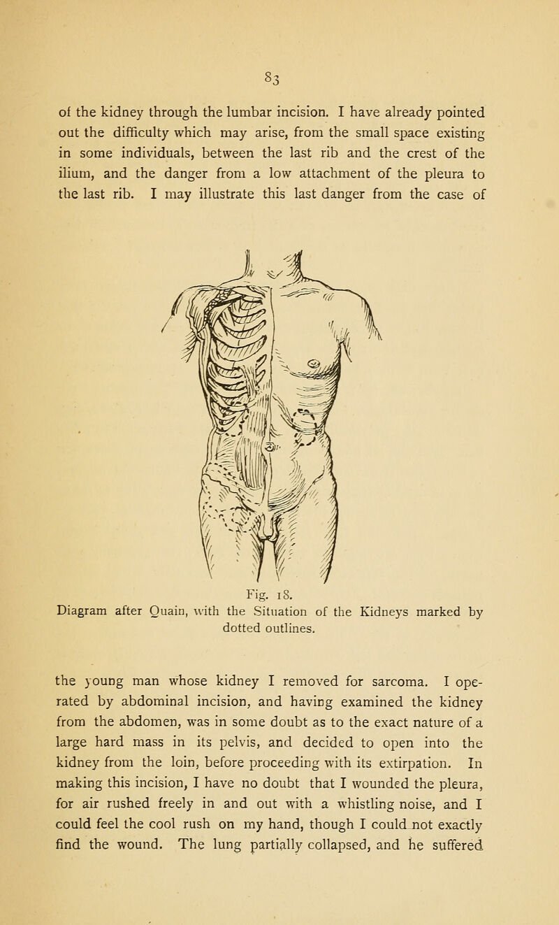 of the kidney through the lumbar incision. I have already pointed out the difficulty which may arise, from the small space existing in some individuals, between the last rib and the crest of the ilium, and the danger from a low attachment of the pleura to the last rib. I may illustrate this last danger from the case of Fig. 18. Diagram after Ouain, with the Situation of the Kidneys marked by dotted outlines. the young man whose kidney I removed for sarcoma. I ope- rated by abdominal incision, and having examined the kidney from the abdomen, was in some doubt as to the exact nature of a large hard mass in its pelvis, and decided to open into the kidney from the loin, before proceeding with its extirpation. In making this incision, I have no doubt that I wounded the pleura, for air rushed freely in and out with a whistling noise, and I could feel the cool rush on my hand, though I could not exactly find the wound. The lung partially collapsed, and he suffered