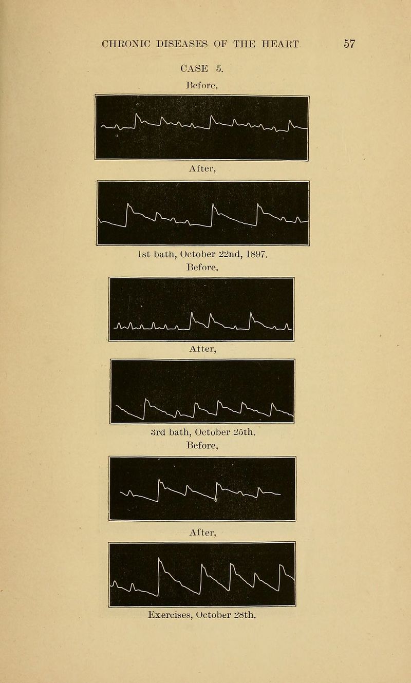 CASE o. Rofore, 1st bath, October '2-2nd, 1897. Before. orcl bath, October 25th. Before, Exercises, October 28th.