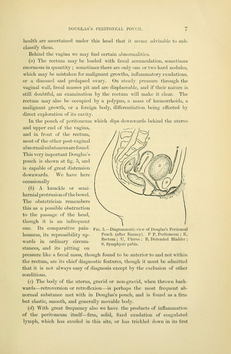 DOUGLASS PEllITONEAL POUCH. r health are ascertained under this head that it seems advisable to sub- classify them. Behind the vagina we may find certain abnormalities. (ct) The rectum may be loaded with fecal accumulation, sometimes enormous in quantity; sometimes there are only one or two hard nodules, which may be mistaken for malignant growths, inflammatory exudations, or a diseased and prolapsed ovarj-. On stead}- pressure through the vaginal wall, fsecal masses pit and are displaceable, and if their nature is still doubtful, an examination by the rectum will make it clear. The rectum may also be occupied by a polypus, a mass of haemorrhoids, a malignant growth, or a foreign body, differentiation being effected by direct exploration of its cavity. In the pouch of peritoneum which dips downwards behind the uterus, and upper end of the vagina, and in front of the rectum, most of the other post-vaginal abnormal substances are found. This very important Douglas's pouch is shown at fig. 5, and is capable of great distension downwards. We have here occasionally ip) A, knuckle or semi- heniial protrusion of the bowel. The obstetrician remembers this as a possible obstruction to the passage of the head, though it is an infrequent one. Its comparative pain- lessness, its repressibility up- wards in ordinary circum- stances, and its pitting on pressure like a fsecal mass, though found to be anterior to and not within the rectum, are its chief diagnostic features, though it must be admitted that it is not always easy of diagnosis except by the cxchision of other conditions. (c) The body of the uterus, gravid or non-gravid, wlicn thrown back- wards—retroversion or retroflexion—is pcrlia])S the most frequent ab- normal substance met with in Douglas's poucli, and is found as a firm but elastic, smooth, and generally movable body. {d) With great frequency also we have the products of inflannnatiou of the peritoneum itself—firm, solid, fixed exudation of coagulated lymph, wliicl) has exiided in this site, or has trickled down in its first Fig. 5.—Diagrammatic view of Douglas's Peritoneal Poucli (after Ranney). P P, Peritoneum ; R, Rectum ; U, Uterus ; B, Distended Bladder ; S, Symphysis i:)ubis.