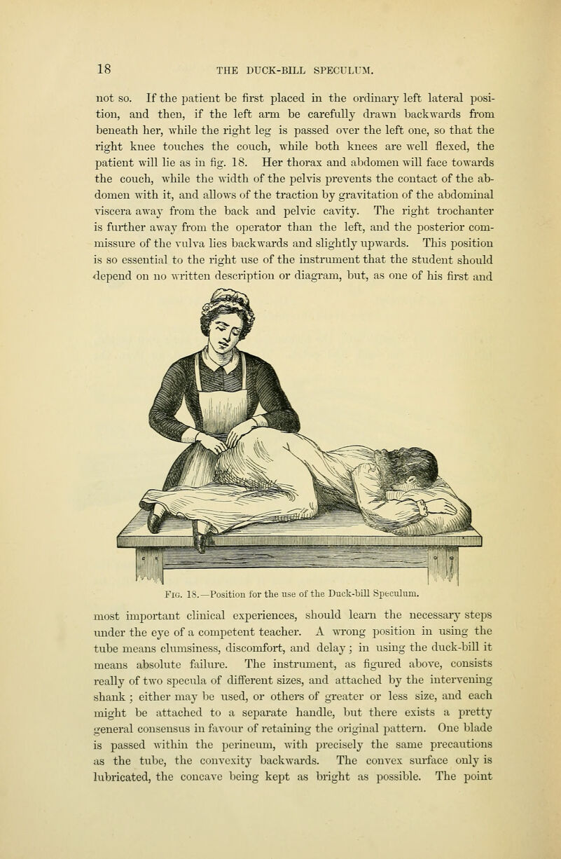 not SO. If the patient be first placed in the ordinary left lateral posi- tion, and then, if the left aim be carefully dra^vn backwards fi'om beneath her, while the right leg is passed over the left one, so that the right knee touches the couch, while both knees are well flexed, the patient will lie as in fig. 18. Her thorax and abdomen will face towards the couch, while the width of the pelvis prevents the contact of the ab- domen with it, and allows of the traction by gravitation of the abdominal viscera away from the back and pelvic cavity. The right trochanter is further away from the operator than the left, and the posterior com- missure of the vulva lies backwards and slightly upwards. This position is so essential to the right use of the instrument that the student should depend on no written description or diagram, but, as one of liis first and Fig. 18.—Position for the use of tlie Duck-bill Speculum. most important clinical experiences, should learn the necessary stej)s under the eye of a competent teacher. A wrong position in using the tube means clumsiness, discomfort, and delay; in using the duck-bill it means absolute failure. The instriunent, as figured above, consists really of two speciila of different sizes, and attached by the intervening shank ; either may be used, or others of greater or less size, and each might be attached to a separate handle, but there exists a pretty general consensus in favour of retaining the original pattern. One blade is passed within the perineum, with precisely the same precautions as the tube, the convexity backwards. The convex surface only is lubricated, the concave being kept as bright as possible. The point