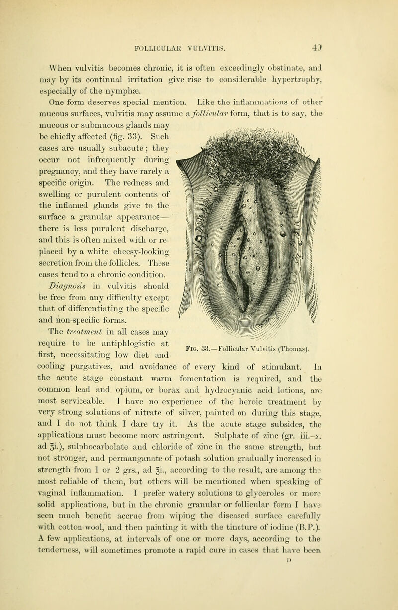 \Mien vulvitis becomes chronic, it is often exceedingly ohstinute, and ijiiiy by its continual irritation give rise to considerable hypei-trophy, especially of the nymphce. One form deserves special mention. Like the inHauimations of other mucous surfaces, vulvitis may assiime sl follicular form, that is to say, the mucous or submucous glands may be chiefly affected (fig. 33). Such cases are usually subacute; they occur not infrequently during pregnancy, and they have rarely a specific origin. The redness and swelling or purulent contents of the inflamed glands give to the surface a granular appearance— there is less purulent discharge, and this is often mixed with or re- placed by a white cheesy-looking secretion from the follicles. These cases tend to a chronic condition. Diagnosis in vulvitis should be free from any difliculty except that of diflierentiating the specific and non-specific forms. The treatment in all cases may require to be antiphlogistic at first, necessitating low diet and cooling purgatives, and avoidance of every kind of stimulant. In the acute stage constant warm fomentation is required, and the common lead and opium, or borax and hydrocyanic acid lotions, arc most serviceable. I have no experience of the heroic treatment by very strong solutions of nitrate of silvei-, imintcd on during this stage, and I do not think I dare try it. As the acute stage subsides, the applications must become more astringent. Sulphate of zinc (gr. iii.-x. ad 5i-)) sulphocarbolate and chloride of zinc in the same strength, but not stronger, and permanganate of potash solution gradually increased in strength from 1 or 2 grs., ad §i., according to the result, arc among tin- most reliable of them, but others will be mentioned when speaking of vaginal inflammation. I prefer watery solutions to gh'ceroles or more solid applications, but in the chronic granular or follicular form I have seen much benefit accrue from wiping the diseased surface carefully with cotton-wool, and then painting it with the tincture of iodine (B.P.). A few applications, at intervals of one or more days, according to the tenderness, will sometimes promote a ra])i<l cure in cases tliat liave been Fig. 33.—Follicular Vulvitis (Thomas).