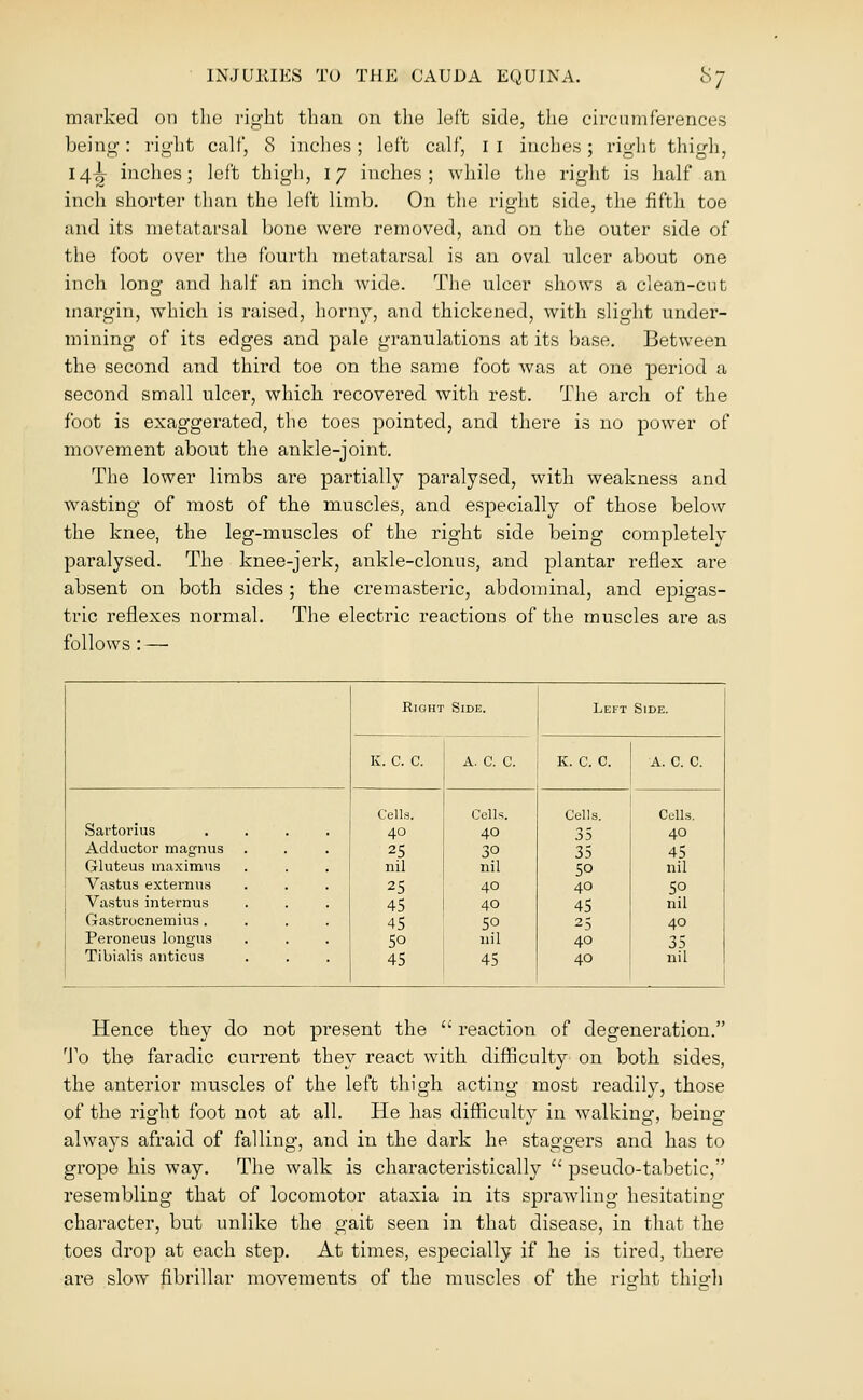 marked on tho riglit than on the left side, tlie circninferences being: right calf, 8 inches; left calf, i i inches; right thigh, 14^ inches; left thigh, 17 inches; while the riglit is half an inch shorter than the left limb. On the right side, the fifth toe and its metatarsal bone were removed, and on the outer side of the foot over the fourth metatarsal is an oval ulcer about one inch long and half an incli wide. The ulcer shows a clean-cut margin, which is raised, horny, and thickened, with slight under- mining of its edges and pale granulations at its base. Between the second and third toe on the same foot was at one period a second small ulcer, which recovered with rest. The arch of the foot is exaggerated, the toes pointed, and there is no power of movement about the ankle-joint. The lower limbs are partially paralysed, with weakness and wasting of most of the muscles, and especially of those below the knee, the leg-muscles of the right side being completely paralysed. The knee-jerk, ankle-clonus, and plantar reflex are absent on both sides; the cremasteric, abdominal, and epigas- tric reflexes normal. The electric reactions of the muscles are as follows: — Hence they do not present the '' reaction of degeneration. ^J'o the faradic current they react with difficulty on both sides, the anterior muscles of the left thigh acting most readily, those of the right foot not at all. He has difficulty in walking, being always afraid of falling, and in the dark he staggers and has to grope his way. The walk is characteristically  pseudo-tabetic, resembling that of locomotor ataxia in its sprawling hesitating character, but unlike the gait seen in that disease, in that the toes drop at each step. At times, especially if he is tired, there are slow fibrillar movements of the muscles of the right thio-}i