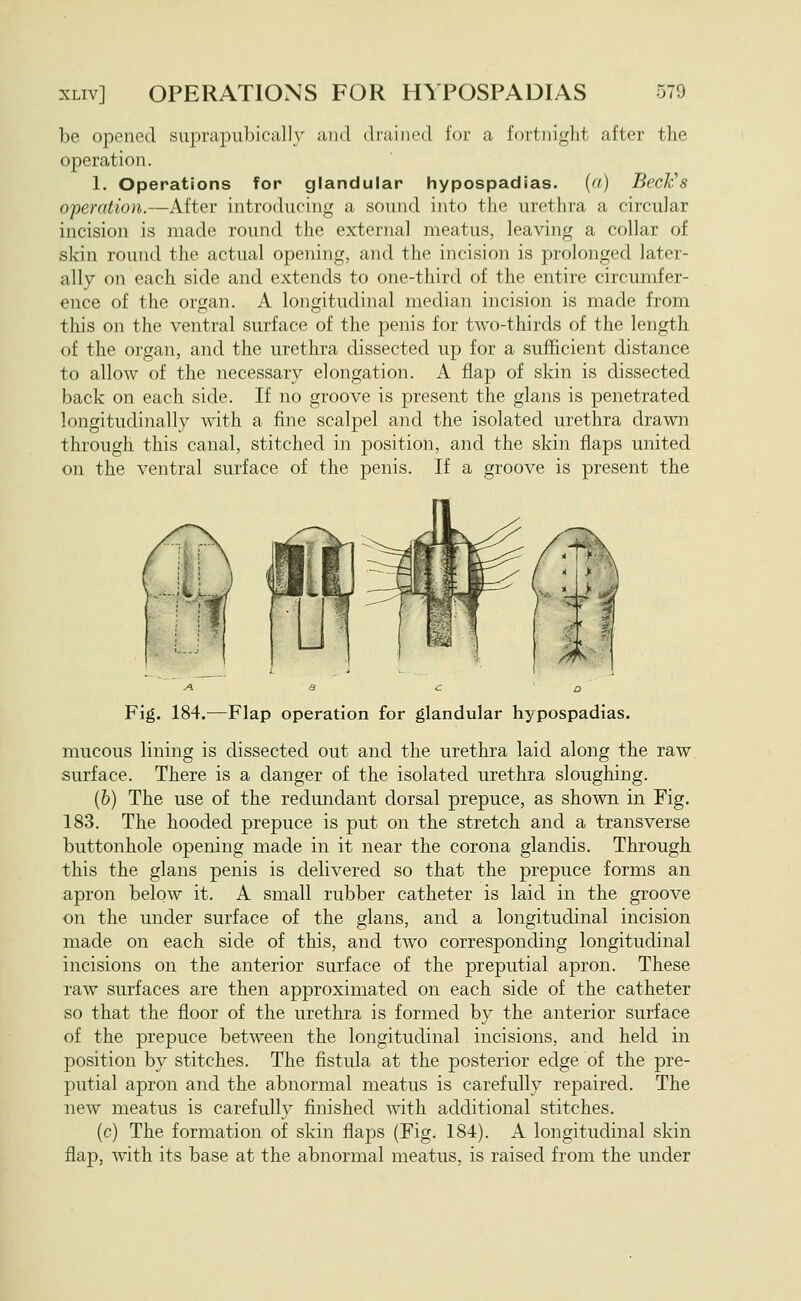 be opened suprapubically and drained for a fortnight after the operation. 1. Operations for glandular hypospadias. (a) Beckys operation.—After introducing a sound into the urethra a circular incision is made round the external meatus, leaving a collar of skin round the actual opening, and the incision is prolonged later- ally on each side and extends to one-third of the entire circumfer- ence of the organ. A longitudinal median incision is made from this on the ventral svirface of the penis for two-thirds of the length of the organ, and the urethra dissected up for a sufficient distance to allow of the necessary elongation. A flap of skin is dissected back on each side. If no groove is present the glans is penetrated longitudinally with a fine scalpel and the isolated urethra drawn through this canal, stitched in position, and the skin flaps united on the ventral surface of the penis. If a groove is present the Fig. 184.—Flap operation for glandular hypospadias. mucous lining is dissected out and the urethra laid along the raw ■surface. There is a danger of the isolated urethra sloughing. (b) The use of the redundant dorsal prepuce, as shown in Fig. 183. The hooded prepuce is put on the stretch and a transverse buttonhole opening made in it near the corona glandis. Through this the glans penis is delivered so that the prepuce forms an apron below it. A small rubber catheter is laid in the groove on the under surface of the glans, and a longitudinal incision made on each side of this, and two corresponding longitudinal incisions on the anterior surface of the preputial apron. These raw surfaces are then approximated on each side of the catheter so that the floor of the urethra is formed by the anterior surface of the prepuce between the longitudinal incisions, and held in position by stitches. The fistula at the posterior edge of the pre- putial apron and the abnormal meatus is carefully repaired. The new meatus is carefully finished with additional stitches. (c) The formation of skin flaps (Fig. 184). A longitudinal skin flap, with its base at the abnormal meatus, is raised from the under