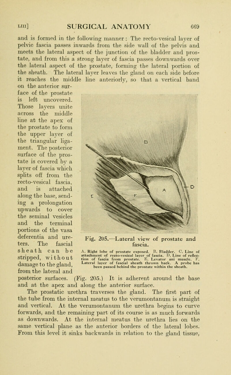 and is formed in the following manner: The recto-vesical layer of pelvic fascia passes inwards from the side wall of the pelvis and meets the lateral aspect of the junction of the bladder and pros- tate, and from this a strong layer of fascia passes downwards over the lateral aspect of the prostate, forming the lateral portion of the sheath. The lateral layer leaves the gland on each side before it reaches the middle line anteriorly, so that a vertical band on the anterior sur- face of the prostate is left uncovered. | Those layers unite ' across the middle line at the apex of the prostate to form the upper layer of the triangular liga- ment. The posterior surface of the pros- tate is covered by a layer of fascia which sphts off from the recto-vesical fascia, and is attached along the base, send- ing a prolongation upwards to cover the seminal vesicles and the terminal portions of the vasa deferentia and ure- ters. The fascial sheath can be stripped, without damage to the gland, from the lateral and posterior surfaces. (Fig. 205.) It is adherent around the base and at the apex and along the anterior surface. The prostatic urethra traverses the gland. The first part of the tube from the internal meatus to the verumontanum is straight and vertical. At the verumontanum the urethra begins to curve forwards, and the remaining part of its course is as much forwards as downwards. At the internal meatus the urethra lies on the same vertical plane as the anterior borders of the lateral lobes. From this level it sinks backwards in relation to the gland tissue. --D Fig, 205.—Lateral view of prostate and fascia. A, Right lobe of prostate exposed. B, Bladder. C, Line of attachment of recto-vesical layer of fascia. D, Line of reflec- tion of fascia from prostate. E, Levator ani muscle. V, Lateral layer of fascial sheath thrown back. A probe has been passed behind the prostate within the sheath.