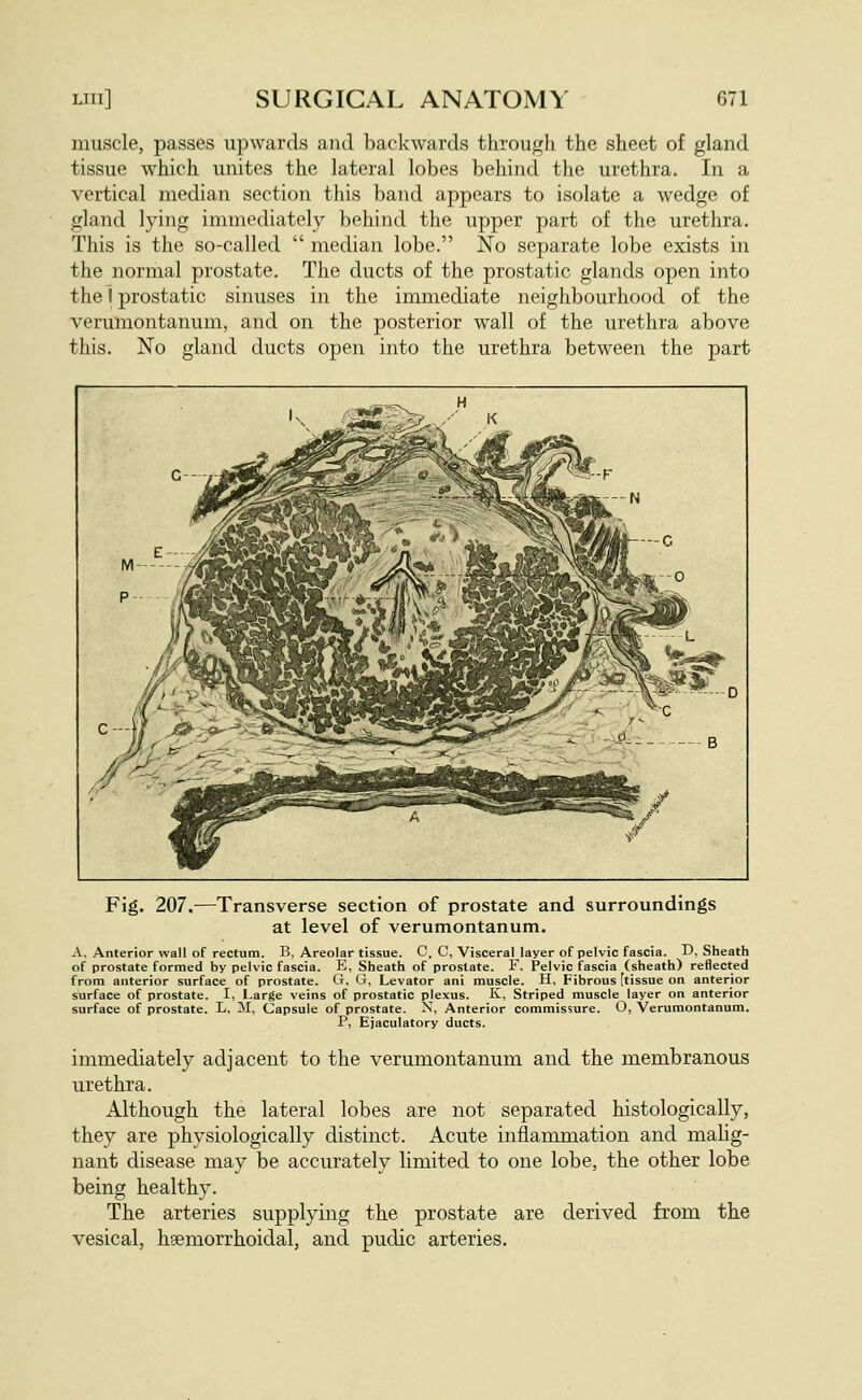 muscle, passes upwards and backwards through the sheet of gland tissue which unites the lateral lobes behind the urethra. In a vertical median section this band appears to isolate a wedge of gland lying immediately behind the upper part of the urethra. This is the so-called  median lobe. No separate lobe exists in the nornaal prostate. The ducts of the prostatic glands open into the I prostatic sinuses in the immediate neighbourhood of the verumontanum, and on the posterior wall of the urethra above this. No gland ducts open into the urethra between the part Fig. 207.—Transverse section of prostate and surroundings at level of verumontanum. A, Anterior wall of rectum. B, Areolar tissue. C, C, Visceral layer of pelvic fascia. D, Sheath of prostate formed by pelvic fascia. E, Sheath of prostate. F, Pelvic fascia (sheath) reflected from anterior surface of prostate. G. G, Levator ani muscle. H, Fibrous [tissue on anterior surface of prostate. I, Large veins of prostatic plexus. K, Striped muscle layer on anterior surface of prostate. L, M, Capsule of prostate. N, Anterior commissure. O, Verumontanum. P, Ejaculatory ducts. immediately adjacent to the verumontanum and the membranous urethra. Although the lateral lobes are not separated histologically, they are physiologically distinct. Acute inflammation and malig- nant disease may be accurately limited to one lobe, the other lobe being healthy. The arteries supplying the prostate are derived from the vesical, hgemorrhoidal, and pudic arteries.