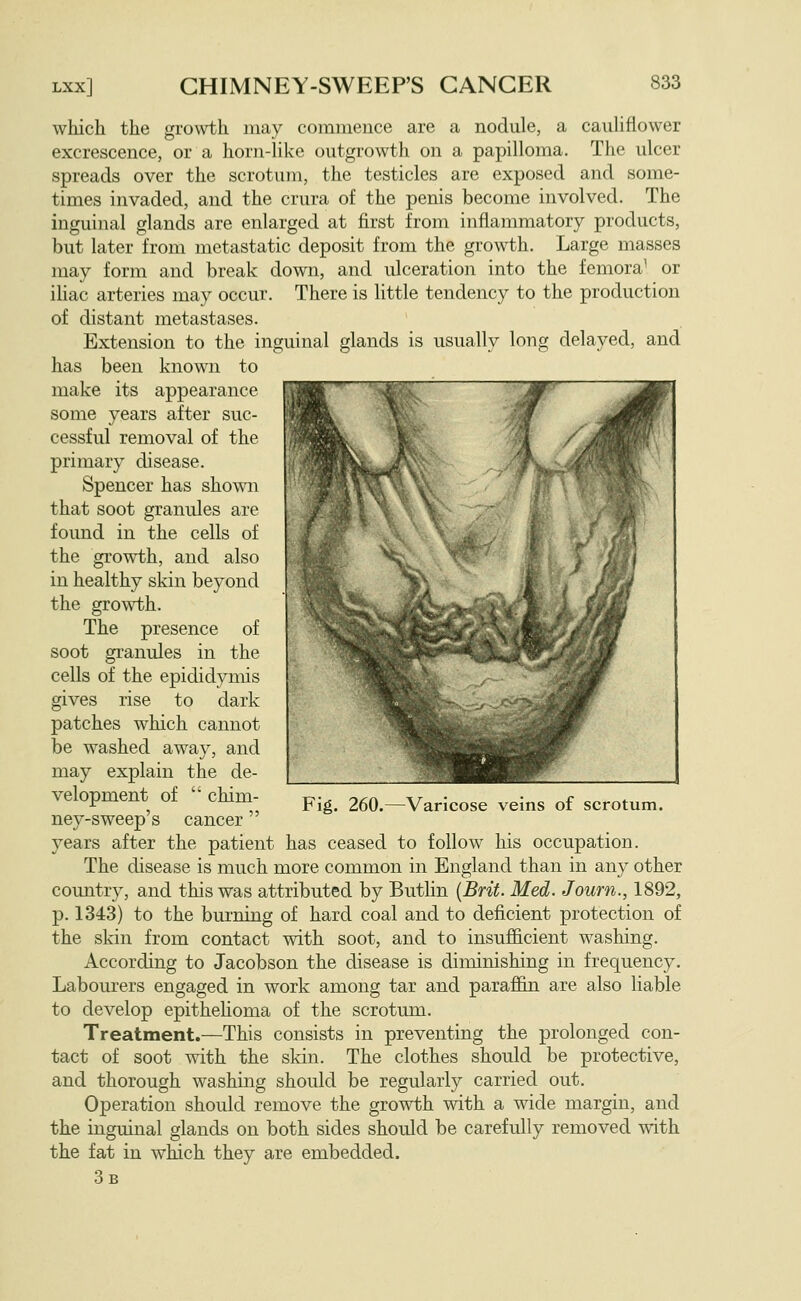 which the gro\vth may commence are a nodule, a cauliflower excrescence, or a horn-like outgrowth on a papilloma. The ulcer spreads over the scrotum, the testicles are exposed and some- times invaded, and the crura of the penis become involved. The inguinal glands are enlarged at first from inflammatory products, but later from metastatic deposit from the growth. Large masses may form and break down, and ulceration into the femora^ or ihac arteries may occur. There is little tendency to the production of distant metastases. Extension to the inguinal glands is usually long delayed, and has been known to make its appearance some years after suc- cessful removal of the primary disease. Spencer has shown that soot granules are found in the cells of the growth, and also in healthy skin beyond the growth. The presence of soot gi'anules in the cells of the epididymis gives rise to dark patches which cannot be washed away, and may explain the de- velopment of  chim- ney-sweep's cancer  years after the patient has ceased to follow his occupation. The disease is much more common in England than in any other country, and this was attributed by Buthn {Brit. Med. Journ., 1892, p. 1343) to the burning of hard coal and to deficient protection of the skin from contact with soot, and to insufficient washing. According to Jacobson the disease is diminishing in frequency. Labourers engaged in work among tar and paraffin are also liable to develop epithehoma of the scrotum. Treatment.—This consists in preventing the prolonged con- tact of soot with the skin. The clothes should be protective, and thorough washing should be regularly carried out. Operation should remove the growth with a wide margin, and the inguinal glands on both sides should be carefully removed with the fat in which they are embedded. 3b Fig. 260.—Varicose veins of scrotum.