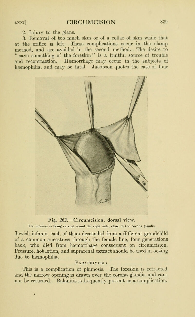 2. Injury to the glans. 3. Removal of too much skin or of a collar of skin while that at the orifice is left. These complications occur in the clamp method, and are avoided in the second method. The desire to  save something of the foreskin  is a fruitful source of trouble and recontraction. Haemorrhage may occur in the subjects of haemophilia, and may be fatal. Jacobson quotes the case of four Fig. 262.—Circumcision, dorsal view. The incision is being carried round the right side, close to the corona glandis. Jewish infants, each of them descended from a different grandchild of a common ancestress through the female line, four generations back, who died from haemorrhage consequent on circumcision. Pressure, hot lotion, and suprarenal extract should be used in oozing due to haemophilia. Paeaphimosis This is a compHcation of phimosis. The foreskin is retracted and the narrow opening is drawn over the corona glandis and can- not be returned. Balanitis is frequently present as a complication.