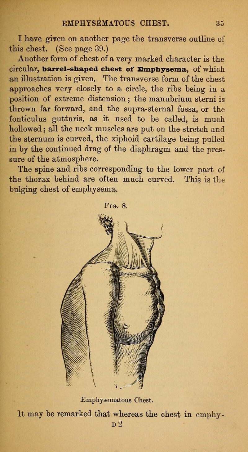 I have given on another page the transverse outline of this chest. (See page 39.) Another form of chest of a very marked character is the circular, barrel-shaped chest of Emphysema, of which an illustration is given. The transverse form of the chest approaches very closely to a circle, the ribs being in a position of extreme distension ; the manubrium sterni is thrown far forward, and the supra-sternal fossa, or the fonticulus gutturis, as it used to be called, is much hollowed; all the neck muscles are put on the stretch and the sternum is curved, the xiphoid cartilage being pulled in by the continued drag of the diaphragm and the pres- sure of the atmosphere. The spine and ribs corresponding to the lower part of the thorax behind are often much curved. This is the bulging chest of emphysema. Fig. 8. Emphysematous Chest. It may be remarked that whereas the chest in emphy- d2