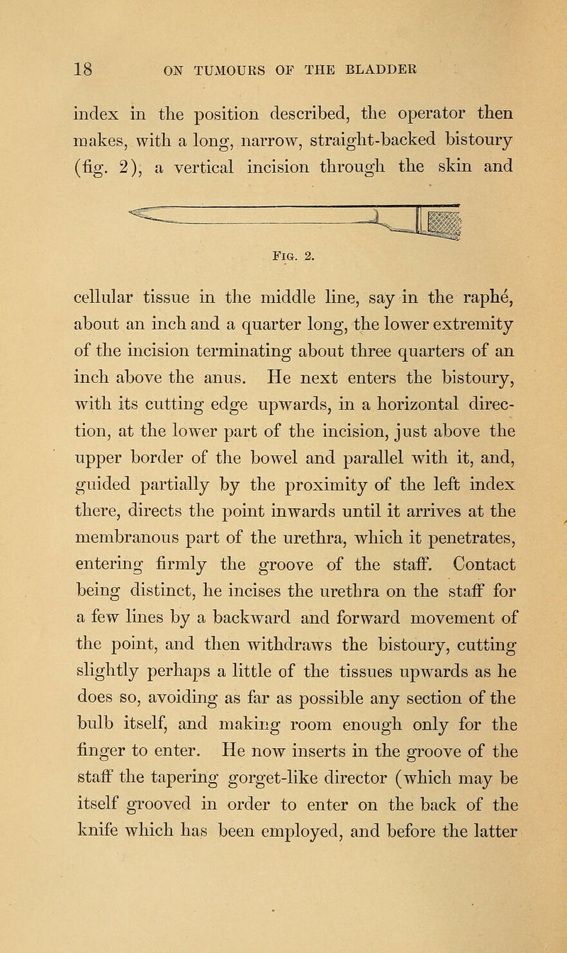 index in the position described, the operator then makes, with a long, narrow, straight-backed bistoury (fig. 2), a vertical incision through the skin and Fig. 2. cellular tissue in the middle line, say in the raphe, about an inch and a quarter long, the lower extremity of the incision terminating about three quarters of an inch above the anus. He next enters the bistoury, with its cutting edge upwards, in a horizontal direc- tion, at the lower part of the incision, just above the upper border of the bowel and parallel with it, and, guided partially by the proximity of the left index there, directs the point inwards until it arrives at the membranous part of the urethra, which it penetrates, entering firmly the groove of the staiF. Contact being distinct, he incises the urethra on the staff for a few lines by a backward and forward movement of the point, and then withdraws the bistoury, cutting slightly perhaps a little of the tissues upwards as he does so, avoiding as far as possible any section of the bulb itself, and making room enough only for the finger to enter. He now inserts in the groove of the staff the tapering gorget-like director (which may be itself grooved in order to enter on the back of the knife which has been employed, and before the latter