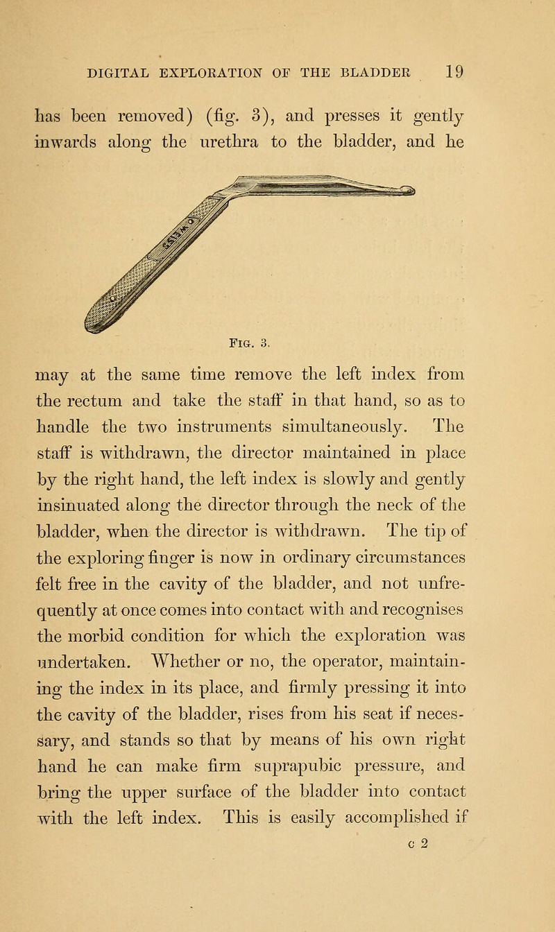has been removed) (fig. 3), and presses it gently inwards along the urethra to the bladder, and he Fig. 3. may at the same time remove the left index from the rectum and take the staff in that hand, so as to handle the two instruments simultaneously. The staff is withdrawn, the director maintained in place by the right hand, the left index is slowly and gently insinuated along the director through the neck of the bladder, when the director is withdrawn. The tip of the exploring finger is now in ordinary circumstances felt free in the cavity of the bladder, and not unfre- quently at once comes into contact with and recognises the morbid condition for which the exploration was undertaken. Whether or no, the operator, maintain- ing the index in its place, and firmly pressing it into the cavity of the bladder, rises from his seat if neces- sary, and stands so that by means of his own right hand he can make firm suprapubic pressure, and bring the upper surface of the bladder into contact with the left index. This is easily accomplished if c 2