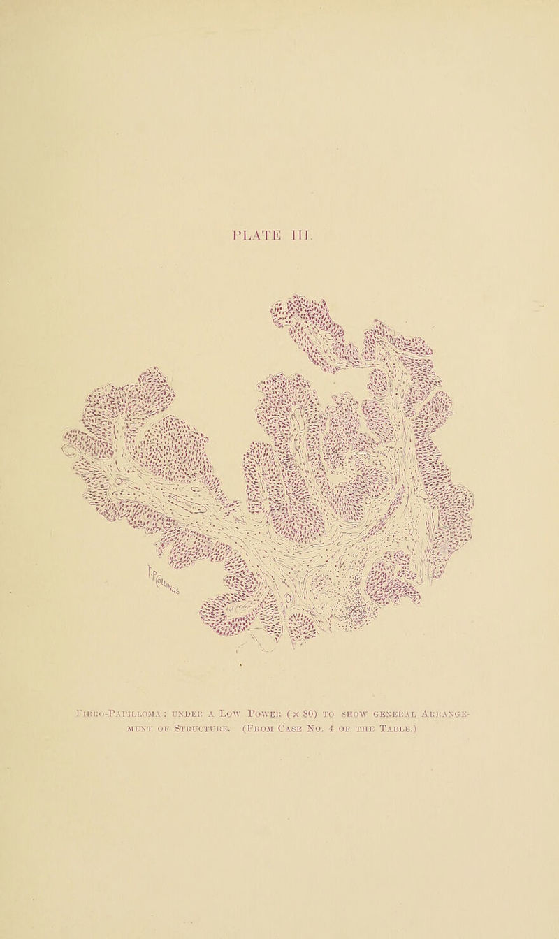 K. I'MlKll-rAriLLO.MA : UNDEU A LoW PoWEll (X 80) TO SHOW GEXEiiAL ^r.\^..\\• MEXT 01'' STUUCTUJiE. (1?E0M CASE NO. i OF THE TABLIS.')
