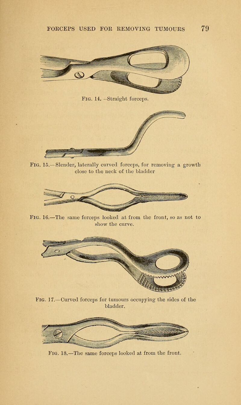 Fig. 14. —Straight forceps. Fig. 15.— Slender, laterally curved forceps, for removing a growth close to the neck of the bladder Fig. 16.—The same forceps looked at from the front, so as not to show the curve. Fig. 17.—Curved forceps for tumours occupying the sides of the bladder. Fig. 18.—The same forceps looked at from the front.