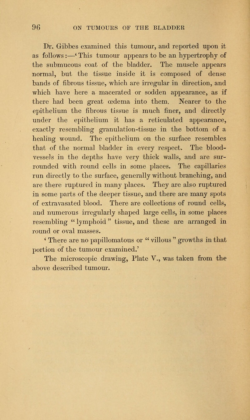 Dr. Gibbes examined this tumour, and reported upon it as follows:—' This tumour appears to be an hypertrophy of the submucous coat of the bladder. The muscle appears normal, but the tissue inside it is composed of dense bands of fibrous tissue, which are irregular in direction, and which have here a macerated or sodden appearance, as if there had been great oedema into them. Nearer to the epithelium the fibrous tissue is much finer, and directly under the epithelium it has a reticulated appearance, exactly resembling granulation-tissue in the bottom of a healing wound. The epithelium on the surface resembles that of the normal bladder in every respect. The blood- vessels in the depths have very thick walls, and are sur- rounded with round cells in some places. The capillaries run directly to the surface, generally without branching, and are there ruptured in many places. They are also ruptured in some parts of the deeper tissue, and there are many spots of extravasated blood. There are collections of round cells, and numerous irregularly shaped large cells, in some places resembling  lymphoid tissue, and these are arranged in round or oval masses. ' There are no papillomatous or  villous  growths in that portion of the tumour examined.' The microscopic drawing, Plate V., was taken from the above described tumour.