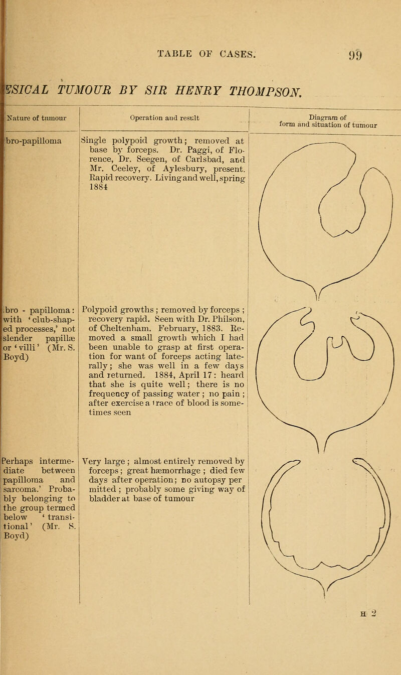 ^SIGAL TUMOUR BY SIR HENRY THOMPSON. Nature of tumour |bro-papilloma ibro - papilloma: with ' club-shap- ed processes,' not slender papillae or'villi' (Mr. S. Boyd) Perhaps interme- diate between papilloma and sarcoma.' Proba- bly belonging to the group termed below ' transi- tional' (Mr. S. Boyd) Operation and result Single polypoid growth; removed at base by forceps. Dr. Paggi, of Flo- rence, Dr. Seegen, of Carlsbad, and Mr. Ceeley, of Aylesbury, present. Rapid recovery. Living and well, spring 1884 Polypoid growths ; removed by forceps ; recovery rapid. Seen with Dr. Philson, of Cheltenham. February, 1883. Re- moved a small growth which I had been unable to grasp at first opera- tion for want of forceps acting late- rally ; she was well in a few days and returned. 1884, April 17: heard that she is quite well; there is no frequeocy of passing water ; no pain ; after exercise a i race of blood is some- times seen Very large ; almost entirely removed by forceps; great hsemorrhage ; died few days after operation; no autopsy per mitted ; probably some giving way of bladder at base of tumour H -2