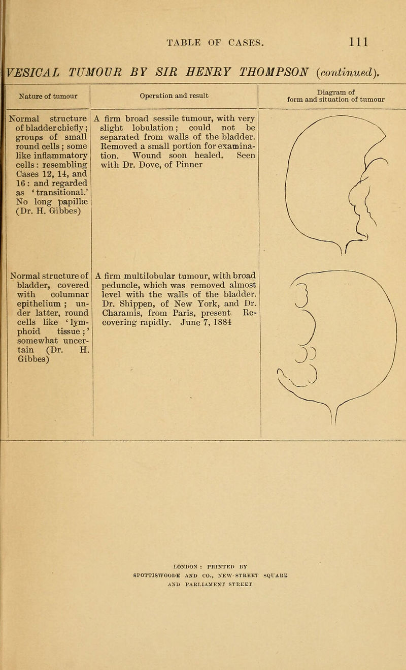 VESICAL TUMOUR BY SIR HENRY THOMPSON (continued). Nature of tumour Operation and result Diagram of form and situation of tumour Normal structure of bladder chiefly; groups of small round cells; some like inflammatory cells: resembling Cases 12, li, and 16: and regarded as ' transitional.' No long papillae (Dr. H. Gibbes) Normal structure of bladder, covered with columnar epithelium ; un- der latter, round cells Uke ' lym- phoid tissue ;' somewhat uncer- tain (Dr. H. Gibbes) A firm broad sessile tumour, with very slight lobulation; could not be separated from walls of the bladder. Removed a small portion for examina- tion. Wound soon healed. Seen with Dr. Dove, of Pinner A firm multilobular tumour, with broad peduncle, which was removed almost level with the walls of the bladder. Dr. Shippen, of New York, and Dr. Charamis, from Paris, present. Re- covering rapidly. June 7, 188-i LOJTDON : PDINTEn I!V SPOTTISWOODE AXD CO., XEW STREET SQUAUK ASD PAEI.I.\iIE5T STREET