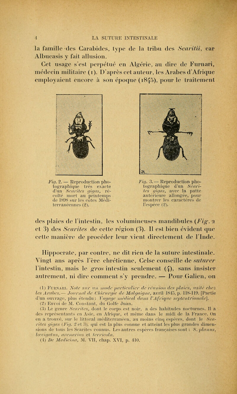 la famille des Garabides, type de la tribu des Scaritii, car Albucasis y fait allusion. Cet usage s'est perpétué en Algérie, au dire de Furnari, médecin militaire (i). D'après cet auteur, les Arabes d'Afrique employaient encore à son époque (1845), pour le traitement Fig. 2. — Reproduction pho- tographique très exacte d'un Scarites gif/as, ré- colté mort au printemps de 1898 sur les cotes Médi- terranéennes (2). Fig. 3. — Reproduction pho- tographique d'un Scari- tes gigas, avec la patte antérieure allongée, pour montrer les caractères de l'espèce (2). des plaies de l'intestin, les volumineuses mandibules {Fig. i et 3) des Scarites de cette région (3). Il est bien évident que cette manière de procéder leur vient directement de l'Inde. Hippocrate, par contre, ne dit rien de la suture intestinale. Vingt ans après l'ère chrétienne, Celse conseille de suturer l'intestin, mais le gros intestin seulement (4), sans insister autrement, ni dire comment s'y prendre. — Pour Galien, on (1) Furnaei. Note sur un mode particulier de réunion des plaies, usité chez- les Arabes.— Journal de C/iirurgie de Malgaigne, avril 1845, p. 118-119. [Partie d'un ouvrage, plus étendu : Voyage médical dans l'Afrique septentrionale]. (2) Envoi de M. Constant, du Golfe Juan. (3) Le genre Scarites,, dont le corps est noir, a des habitudes nocturnes. Il a des représentants en Asie, en Afrique, et même dans le midi de la France. On en a trouvé, sur le littoral méditerranéen, au moins cinq espèces, dont le Sca- rites gigas (Fig. 2 et 3), qui est lapins connue et atteint les plus grandes dimen- sions de tous les Scarites connus. Les autres espèces françaises sont : S.planus, lœvigatus, arenarius et tcrricola. (4) De Medieina, M. VII, chap. XVI, p. 410.