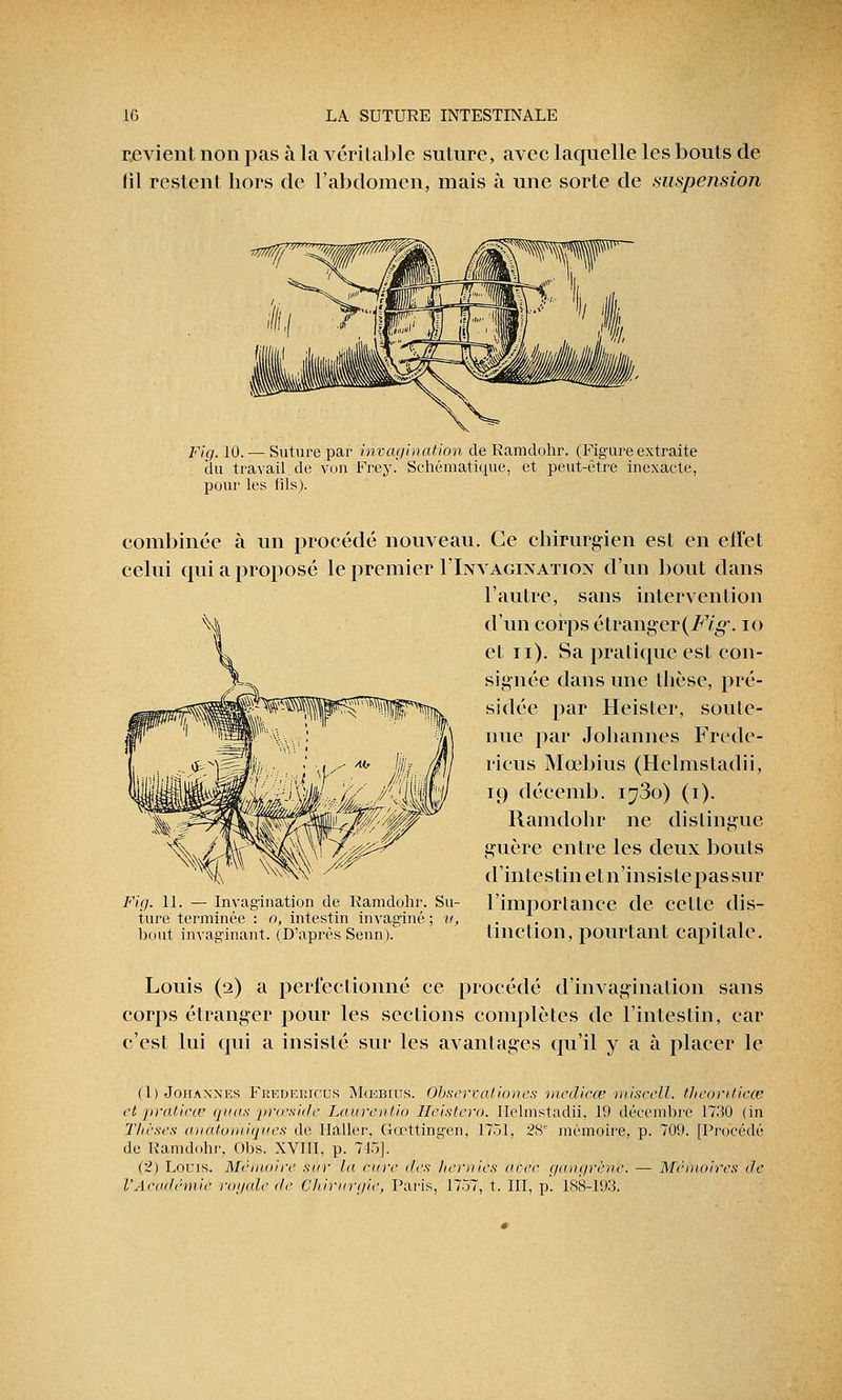 revient non pas à la véritable suture, avec laquelle les bouts de fil restent hors de l'abdomen, mais à une sorte de suspension Fi g. 10. — Suture par invagination de Ramdohr. (Figure extraite du travail.de von Frey.' Schématique, et peut-être inexacte, pour les lils). combinée à un procédé nouveau. Ce chirurgien est en eiret celui qui a proposé le premier 1'Invagination d'un bout dans l'autre, sans intervention d'un corps étranger (M»*, io et n). Sa pratique est con- signée dans une thèse, pré- sidée par Heister, soute- nue par Johannes Frede- ricus Mœbius (Helmstadii, 19 décemb. 1730) (1). Ramdohr ne distingue guère entre les deux bouts d'intestin et n'insistepas sur Fig. 11. — Invagination de Ramdohr. Su- l'importance de cette (lis- ture terminée : o, intestin invaginé ; u, . bout imaginant. (D'après Senn). tlliction, pourtant capitale. Louis (2) a perfectionné ce procédé d'invagination sans corps étranger pour les sections complètes de l'intestin, car c'est lui qui a insisté sur les avantages qu'il y a à placer le (1) Johannes Fkedericus Mœbius. Observationes mediece misccll. thcoriticce et praticce qitas prœside Laurentio Heistero. Helmstadii, 19 décembre 1730 (in Thèses ancitomiques de Ilaller, Gœttingen, 1751, 28e mémoire, p. 709. [Procédé de Ramdohr, Obs. XVIII, p. 745]. (2) Louis. Mémoire sur la rare des lier nies axer gangrène. — Mémoires de l'Académie royale de Chirurgie, Paris, 1757, t. III, p. 188-193.