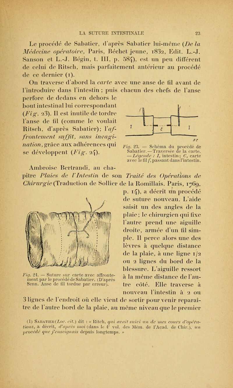 Le procédé de Sabatier, d'après Sabatier lui-même {De la Médecine opératoire, Paris, Béchet jeune, i832, Edit. L.-J. Sanson cl L.-.T. Bégïn, t. III, p. 584), cst un peu différent de celui de Ritsch, mais parfaitement antérieur au procédé de ce dernier (i). On traverse d'abord la carte avec une anse de fil avant de l'introduire dans l'intestin ; puis chacun des chefs de l'anse perfore de dedans en dehors le bout intestinal lui correspondant {Fig. 23). Il est inutile de tordre l'anse de fil (comme le voulait Ritsch, d'après Sabatier); Vaf- frontement suffit, sans invagi- nation, grâce aux adhérences qui se développent {Fig. 24). /! & Fia. 23. — Schéma du procédé de Sabatier. — Traversée de la carte. — Légende : I, intestin; C, carte avec le fil /', passant dans l'intestin. Ambroise Bertrandi, au cha- pitre Plaies de l'Intestin de son Traité des Opérations de Chirurgie (Traduction de Sollier de la Romillais. Paris, 1769, p. 14), a décrit un procédé de suture nouveau. L'aide saisit un des angles de la plaie ; le chirurgien qui fixe l'autre prend une aiguille droite, armée d'un fil sim- ple. Il perce alors une des lèvres à quelque distance de la plaie, à une ligne 1/2 ou 2 lignes du bord de la blessure. L'aiguille ressort à la même distance de l'au- tre côté. Elle traverse à nouveau l'intestin à 2 ou 3 lignes de l'endroit où elle vient de sortir pour venir reparaî- tre de l'autre bord de la plaie, au même niveau que le premier Fig. 24. — Suture sur carte avec affronte- ment par le procédé de Sabatier. (D'après Senn. Anse de fil tordue par erreur). (1) Sabatier (Zoc. cit.) dit : « Ritch, qui avait suivi un de mes cours d'opéra- tions, a décrit, d'après moi (dans le 4e vol. des Mém. de l'Acad. de Chir.), un procédé que j'enseignais depuis longtemps. »