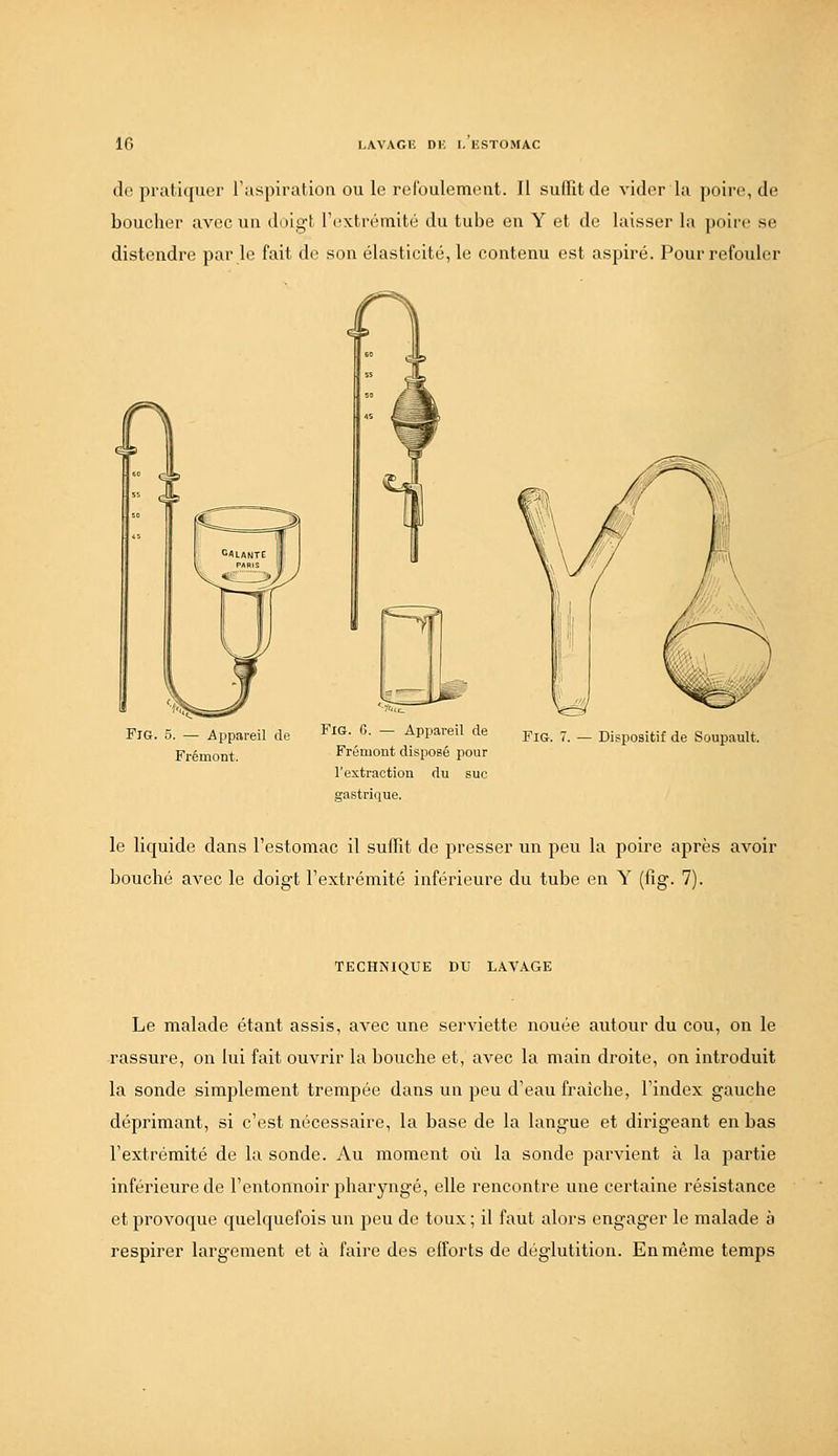 de pr;iti([UL'r l'aspiration ou le roroulemi'ut. Il sulfit de vider la poire, de bouclier avec un doigt l'c^xtrémité du tube eu Y et de laisser la poirt' se distendre par le fait de son élasticité, le contenu est aspiré. Pour refouler FiG. 5. — Appareil de Frémont. FiG. 6. — Appareil de Frémont disposé pour l'extraction du suc gastrique. FiG. 7. — Dispositif de Soupault. le liquide dans l'estomac il suffît de presser un peu la poire après avoir bouché aA^ec le doigt l'extrémité inférieure du tube en Y (iîg. 7). TECHNIQUE DU LAVAGE Le malade étant assis, avec une serviette nouée autour du cou, on le rassure, ou lui fait ouvrir la bouche et, avec la main droite, on introduit la sonde simplement trempée dans un peu d'eau fraîche, l'index gauche déprimant, si c'est nécessaire, la base de la langue et dirigeant en bas l'extrémité de la sonde. Au moment où la sonde parvient à la partie inférieure de l'entonnoir pharyngé, elle rencontre une certaine résistance et provoque quelquefois un peu de toux ; il faut alors engager le malade à respirer largement et à faire des efforts de déglutition. En même temps