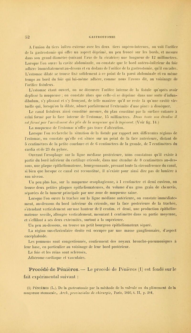 A rnnion du tici's iiiféro-cxtcriic avoc 1rs ilciix liui'S supOro-iud'inûs, dii vnit rorilici- (le la gaslrostoinie qui oITro un aspect (li'iniiuc, nu peu froncé sur les hurds, cl ihi^sim'i; dans son grand diainélrc (suivant l'axe de la cleatrice) une lougneur de 12 uiilliuiètri's. Loi'sque l'on ouvre la cavité abdominale, on constate que le bord anléro-inféncur du foie adhère immédiatement au-dessus et en dedans de l'orilice de la gasiroslomie, ipi'il encadre. L'estomac dilate se trouve fixé soliilenient à ce point de la paroi abdominale et en nièuie temps au bord du l'oie cpii lui-même adhère, comme nous l'avons dil, au voisinage de rorilice fistulenx. L'estomac élant ouvert, on ne découvre l'orilice interne de la listule (pi'aprés avoir déplissé la muqueuse ; on constate alors que celle-ci se déprime dans une sorte d'infun- dibulum, s'y plissant et s'y fronçant, de telle manière qu'il ne reste là (pi'une cavité vir- tuelle qui, lorsqu'on la dilate, admet |iarfaiteuient l'extrémité d'une i>ince à disséquer. Le canal fistuleux ainsi constitue mesure, du plan constitué par la siu'l'ace cutanée à celui forme par la face interne de l'estomac, 15 nullimètres. Daim tontr xan clfudnc il est fermé par l'accoîement des plis de la muqueuse qui le tapissent. (Voir llg. 14.) La muqueuse de l'estomac n'offre pas trace d'alléralion. Lorsque l'on recherche la situation de la fistule par rapport aux dilferenles régions de l'estomac, on constate qu'elle est située sur un point de la face antérieure, distant de 5 centimètres de la petite courbure et de G centimètres de la grande, de 7 centimètres du cardia et de 23 du pylore. Ouvrant l'œsophage sur la ligue médiane postérieure, nous coiislalons (|u'il exisie à partir du bord inférieur du cartilage cricoïde, dans une étendue de 8 centimètres au-des- sous, une plaque épithéliomateuse, bourgeonnante, prenant toute la circonférence du canal, si bien que lorsque ce canal est reconstitué, il n'existe pour ainsi dire pas de lumière à son niveau. Un peu plus bas, sur la muqueuse œsophagienne, à 1 centimètre et demi environ, on trouve deux petites plaques cpithéliomateuscs, du volume d'un gros grain de chènevis, séparées de la tumeur principale par une zone de muqueuse saine. Lorsque l'on ouvre la trachée sur la ligne médiane antérieure, on constate immédiate- ment, au-dessous du bord inférieur du cricoïde, sur la face postérieure de la trachée, s'ctendant verticalement sur une hauteur de 2 centim. et demi, une production épithélio- mateuse sessile, allongée verticalement, mesurant 1 centimètre dans sa partie moyenne, et s'efiilant à ses deux extrémités, surtout à la supérieure. Un peu au-dessous, on trouve un petit bourgeon épithélioraatcux séparé. La région sus-claviculaire droite est occupée par une masse ganglionnaire, d'aspect encéphaloïde. Les poumons sont congestionnés, contiennent des noyaux broncho-pneumoni(iues à leur base, en particulier au voisinage de leur bord posiérieur. Le foie et les reins sont sclérosés. Athérome cardiaciue cl vaseulaire. Procédé de Péiiières.— Le procédé de Pénières (1) est fondé sur le fait expérimental suivant : (1) PÉNIÈBES (L.). De la gastrostomie par la méthode de la valvule ou du plissement de la muqueuse stomacale. Arcli. proviiieialcs de chirurgie, Paris, 189iî, t. II, p. 284.