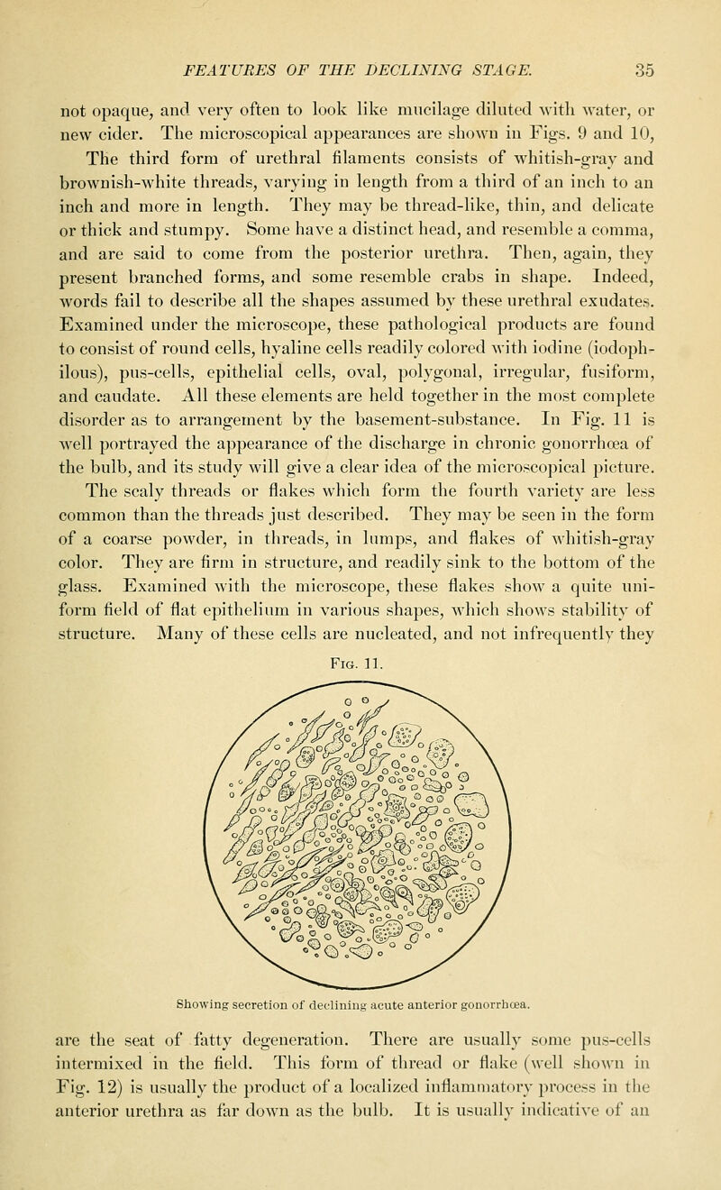 not opaque, and very often to look like mucilage diluted with water, or new cider. The microscopical appearances are shown in Figs. 9 and 10, The third form of urethral filaments consists of whitish-gray and brownish-white threads, varying in length from a third of an inch to an inch and more in length. They may be thread-like, thin, and delicate or thick and stumpy. Some have a distinct head, and resemble a comma, and are said to come from the posterior urethra. Then, again, they present branched forms, and some resemble crabs in shape. Indeed, words fail to describe all the shapes assumed by these urethral exudates. Examined under the microscope, these pathological products are found to consist of round cells, hyaline cells readily colored with iodine (iodoph- ilous), pus-cells, epithelial cells, oval, polygonal, irregular, fusiform, and caudate. All these elements are held together in the most complete disorder as to arrangement by the basement-substance. In Fig. 11 is well portrayed the appearance of the discharge in chronic gonorrhoea of the bulb, and its study will give a clear idea of the microscopical picture. The scaly threads or flakes which form the fourth variety are less common than the threads just described. They may be seen in the form of a coarse powder, in threads, in lumps, and flakes of whitish-gray color. They are firm in structure, and readily sink to the bottom of the glass. Examined with the microscope, these flakes show a quite uni- form field of flat epithelium in various shapes, which shows stability of structure. Many of these cells are nucleated, and not infrequently they Fig. 11. Showing secretion of declining acute anterior gonorrhoea. are the seat of fatty degeneration. There are usually some pus-cells intermixed in the field. This form of thread or flake (well shown in Fig. 12) is usually the product of a localized inflammatory process in the anterior urethra as far down as the bulb. It is usually indicative of an