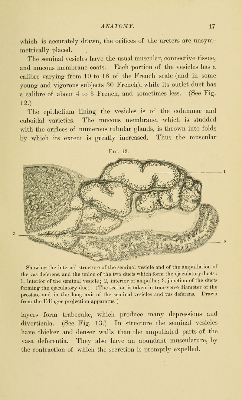 which is accurately drawn, the orifices of the ureters are unsym- metrically placed. The seminal vesicles have the usual muscular, connective tissue, and mucous membrane coats. Each portion of the vesicles has a calibre varying from 10 to 18 of the French scale (and in some young and vigorous subjects 30 French), while its outlet duct has a calibre of about 4 to 6 French, and sometimes less. (See Fig. 12.) The epithelium lining the vesicles is of the columnar and cuboidal varieties. The mucous membrane, which is studded with the orifices of numerous tubular glands, is thrown into folds by which its extent is greatly increased. Thus the muscular Fig. 13. Showing the internal structure of the seminal vesicle and of the ampullation of the vas deferens, and the union of the two ducts which form the ejaculatory ducts : 1, interior of the seminal vesicle; 2, interior of ampulla ; 3, junction of the ducts forming the ejaculatory duct. (The section is taken in transverse diameter of the prostate and in the long axis of the seminal vesicles and vas deferens. Drawn from the Edinger projection apparatus.) layers form trabeculse, which produce many depressions and diverticula. (See Fig. 13.) In structure the seminal vesicles have thicker and denser walls than the ampullated parts of the vasa deferentia. They also have an abundant musculature, by the contraction of which the secretion is promptly expelled.
