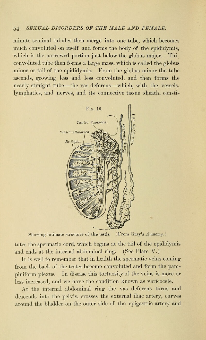 minute seminal tubules then merge into one tube, which becomes much convoluted on itself and forms the body of the epididymis, which is the narrowed portion just below the globus major. Thi convoluted tube then forms a large mass, which is called the globus minor or tail of the epididymis. From the globus minor the tube ascends, growing less and less convoluted, and then forms the nearly straight tube—the vas deferens—which, with the vessels, lymphatics, and nerves, and its connective tissue sheath, consti- FiG. 16. Tunica Vaginalis, ^unica Albuginea. Its Septa. Showing intimate structure of the testis. (From Gray's Anatomy.) tutes the spermatic cord, which begins at the tail of the epididymis and ends at the internal abdominal ring. (See Plate V.) It is well to remember that in health the spermatic veins coming from the back of the testes become convoluted and form the pam- piniform plexus. In disease this tortuosity of the veins is more or less increased, and we have the condition known as varicocele. At the internal abdominal ring the vas deferens turns and descends into the pelvis, crosses the external iliac artery, curves around the bladder on the outer side of the epigastric artery and