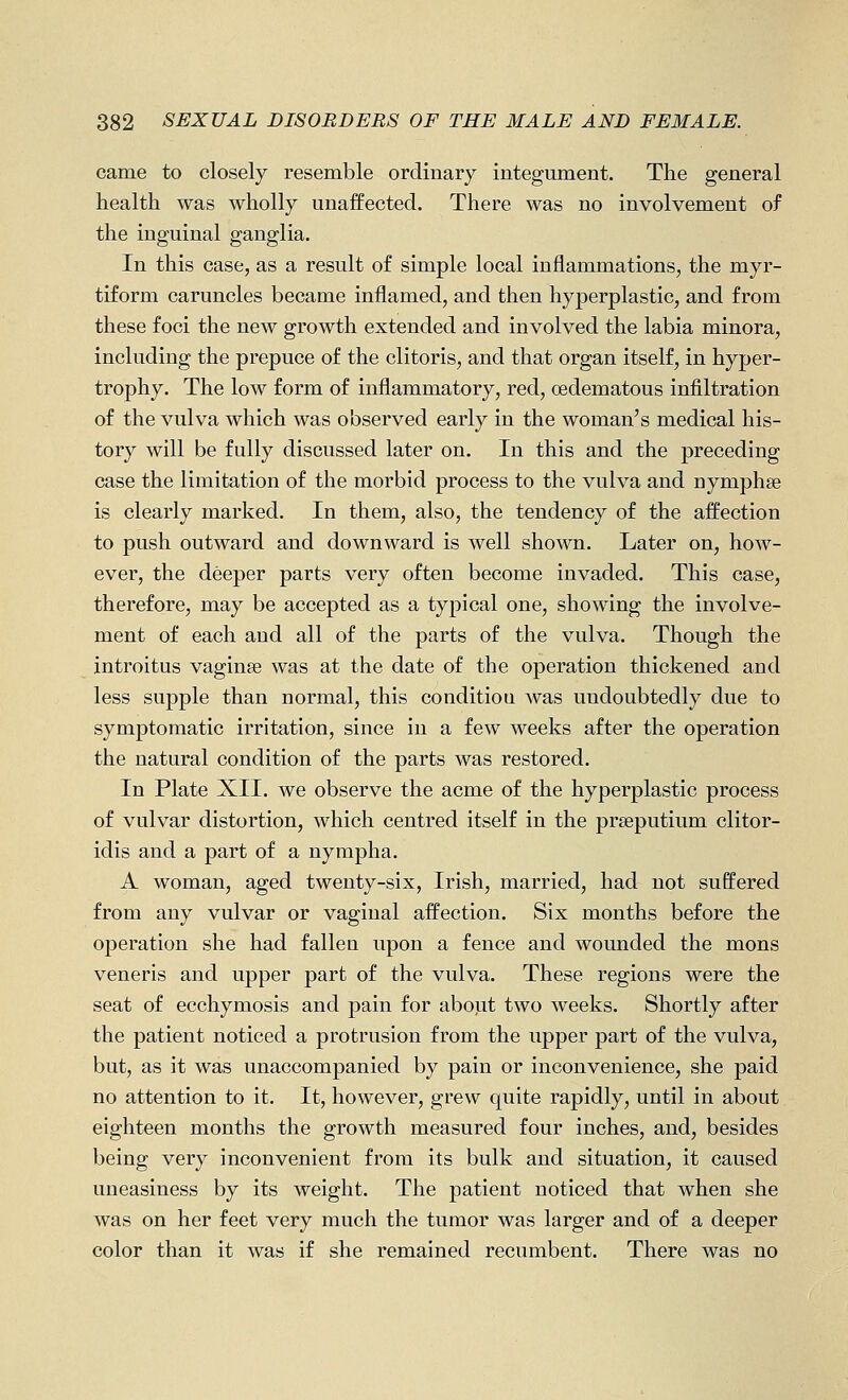 came to closely resemble ordinary integument. The general health was wholly unaffected. There was no involvement of the inguinal ganglia. In this case, as a result of simple local inflammations, the myr- tiform caruncles became inflamed, and then hyperplastic, and from these foci the new growth extended and involved the labia minora, including the prepuce of the clitoris, and that organ itself, in hyper- trophy. The low form of inflammatory, red, oedematous infiltration of the vulva which was observed early in the woman^s medical his- tory will be fully discussed later on. In this and the preceding case the limitation of the morbid process to the vulva and nymphse is clearly marked. In them, also, the tendency of the affection to push outward and downward is well shown. Later on, how- ever, the deeper parts very often become invaded. This case, therefore, may be accepted as a typical one, showing the involve- ment of each and all of the parts of the vulva. Though the introitus vaginae was at the date of the operation thickened and less supple than normal, this condition was undoubtedly due to symptomatic irritation, since in a few weeks after the operation the natural condition of the parts was restored. In Plate XII. we observe the acme of the hyperplastic process of vulvar distortion, which centred itself in the prseputium clitor- idis and a part of a nympha. A woman, aged twenty-six, Irish, married, had not suffered from any vulvar or vaginal affection. Six months before the operation she had fallen upon a fence and wounded the mons veneris and upper part of the vulva. These regions were the seat of ecchymosis and pain for about two weeks. Shortly after the patient noticed a protrusion from the upper part of the vulva, but, as it was unaccompanied by pain or inconvenience, she paid no attention to it. It, however, grew quite rapidly, until in about eighteen months the growth measured four inches, and, besides being very inconvenient from its bulk and situation, it caused uneasiness by its weight. The patient noticed that when she was on her feet very much the tumor was larger and of a deeper color than it was if she remained recumbent. There was no