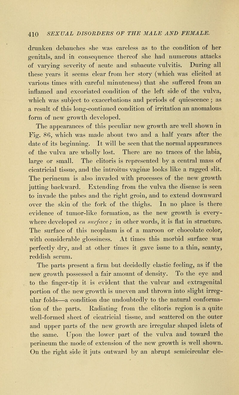 drunken debauches she was careless as to the condition of her genitals, and in consequence thereof she had numerous attacks of varying severity of acute and subacute vulvitis. During all these years it seems clear from her story (which was elicited at various times with careful minuteness) that she suffered from an inflamed and excoriated condition of the left side of the vulva, which was subject to exacerbations and periods of quiescence; as a result of this long-continued condition of irritation an anomalous form of new growth developed. The appearances of this peculiar new growth are well shown in Fig. 86, which was made about two and a half years after the date of its beginning. It will be seen that the normal appearances of the vulva are wholly lost. There are no traces of the labia, large or small. The clitoris is represented by a central mass of cicatricial tissue, and the introitus vaginae looks like a ragged slit. The perineum is also invaded with processes of the new growth jutting backward. Extending from the vulva the disease is seen to invade the pubes and the right groin, and to extend downward over the skin of the fork of the thighs. In no place is there evidence of tumor-like formation, as the new growth is every- where developed en surface; in other words, it is flat in structure. The surface of this neoplasm is of a maroon or chocolate color, with considerable glossiness. At times this morbid surface was perfectly dry, and at other times it gave issue to a thin, scanty, reddish serum. The parts present a firm but decidedly elastic feeling, as if the new growth possessed a fair amount of density. To the eye and to the finger-tip it is evident that the vulvar and extragenital portion of the new growth is uneven and thrown into slight irreg- ular folds—a condition due undoubtedly to the natural conforma- tion of the parts. Radiating from the clitoris region is a quite well-formed sheet of cicatricial tissue, and scattered on the outer and upper parts of the new growth are irregular shaped islets of the same. Upon the lower part of the vulva and toward the perineum the mode of extension of the new growth is well shown. On the right side it juts outward by an abrupt semicircular ele-