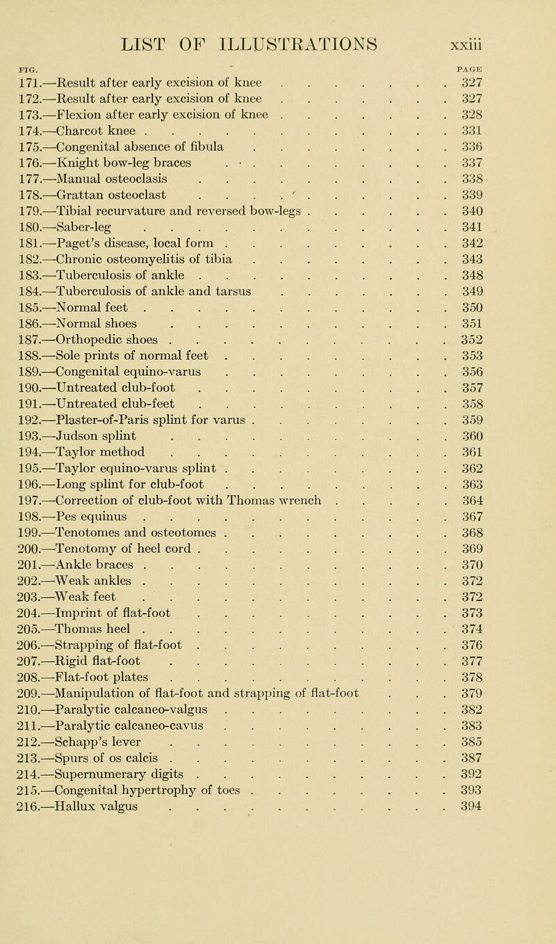 FIG. PAGE 171.—Result after early excision of knee 327 172.—Result after early excision of knee 327 173.—Flexion after early excision of knee 328 174.—Charcot knee 331 175.—Congenital absence of fibula 336 176.—Knight bow-leg braces . ■ 337 177.—Manual osteoclasis 338 178.—Grattan osteoclast . . . . ' 339 179.—Tibial recurvature and reversed bow-legs 340 180.—Saber-leg 341 181.—Paget's disease, local form 342 182.—Chronic osteomyelitis of tibia 343 183.—Tuberculosis of ankle 348 184.—Tuberculosis of ankle and tarsus 349 185.—Normal feet 350 186.—Normal shoes 351 187.—Orthopedic shoes 352 188.—Sole prints of normal feet 353 189.—Congenital equino-varus 356 190.—Untreated club-foot 357 191.—Untreated club-feet 358 192.—Plaster-of-Paris splint for varus 359 193.—Judson splint 360 194.—Taylor method 361 195.—Taylor equino-varus splint 362 196.—Long splint for club-foot 363 197.—Correction of club-foot with Thomas wrench 364 198.—Pes equinus 367 199.—Tenotomes and osteotomes 368 200.—Tenotomy of heel cord 369 201.—Ankle braces 370 202.—Weak ankles 372 203.—Weak feet 372 204.—Imprint of flat-foot 373 205.—Thomas heel 374 206.—Strapping of flat-foot 376 207.—Rigid flat-foot 377 208.—Flat-foot plates 378 209.—Manipulation of flat-foot and strapping of flat-foot . . . 379 210.—Paralytic calcaneo-valgus 382 211.—Paralytic calcaneo-cavus 383 212.—Schapp's lever 385 213.—Spurs of OS calcis 387 214.—Supernumerary digits 392 215.—Congenital hypertrophy of toes ........ 393 216.—Hallux valgus 394