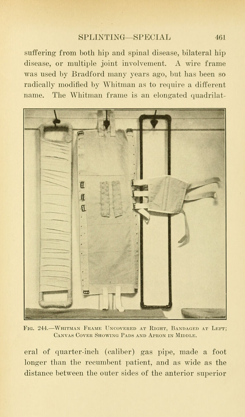 suffering from ])otli hip and spinal disease, bilateral hip disease, or multiple joint involvement. A wire frame was used by Bradford many years ago, but has been so radically modified by Whitman as to require a different name. The Whitman frame is an elongated quadrilat- FiG. 244.—Whitman Frame Uncovered at Right, Bandaged at Left; Canvas Cover Showing Pads and Apron in IMiddle. eral of quarter-inch (caliber) gas pipe, made a foot longer than the recumbent patient, and as wide as the distance between the outer sides of the anterior superior