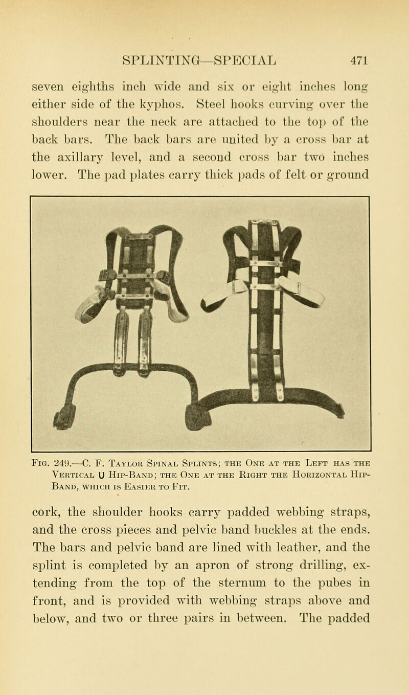 seven eighths inch wide and six or eii^-ht inches long either side of the kyphos. Steel hooks curving over the shoulders near the neck are attached to the top of the back bars. The back bars are united by a cross bar at the axillary level, and a second cross bar two inches lower. The pad plates carry thick pads of felt or ground Fig. 249.—C. F. Taylor Spinal Splints; the One at the Left has the Vertical U Hip-Band; the One at the Right the Horizontal Hip- Band, WHICH IS Easier to Fit. cork, the shoulder hooks carry padded webbing straps, and the cross pieces and pelvic band buckles at the ends. The bars and pelvic band are lined with leather, and the splint is completed by an apron of strong drilling, ex- tending from the top of the sternum to the pubes in front, and is provided with webbing straps above and below, and two or three pairs in between. The padded
