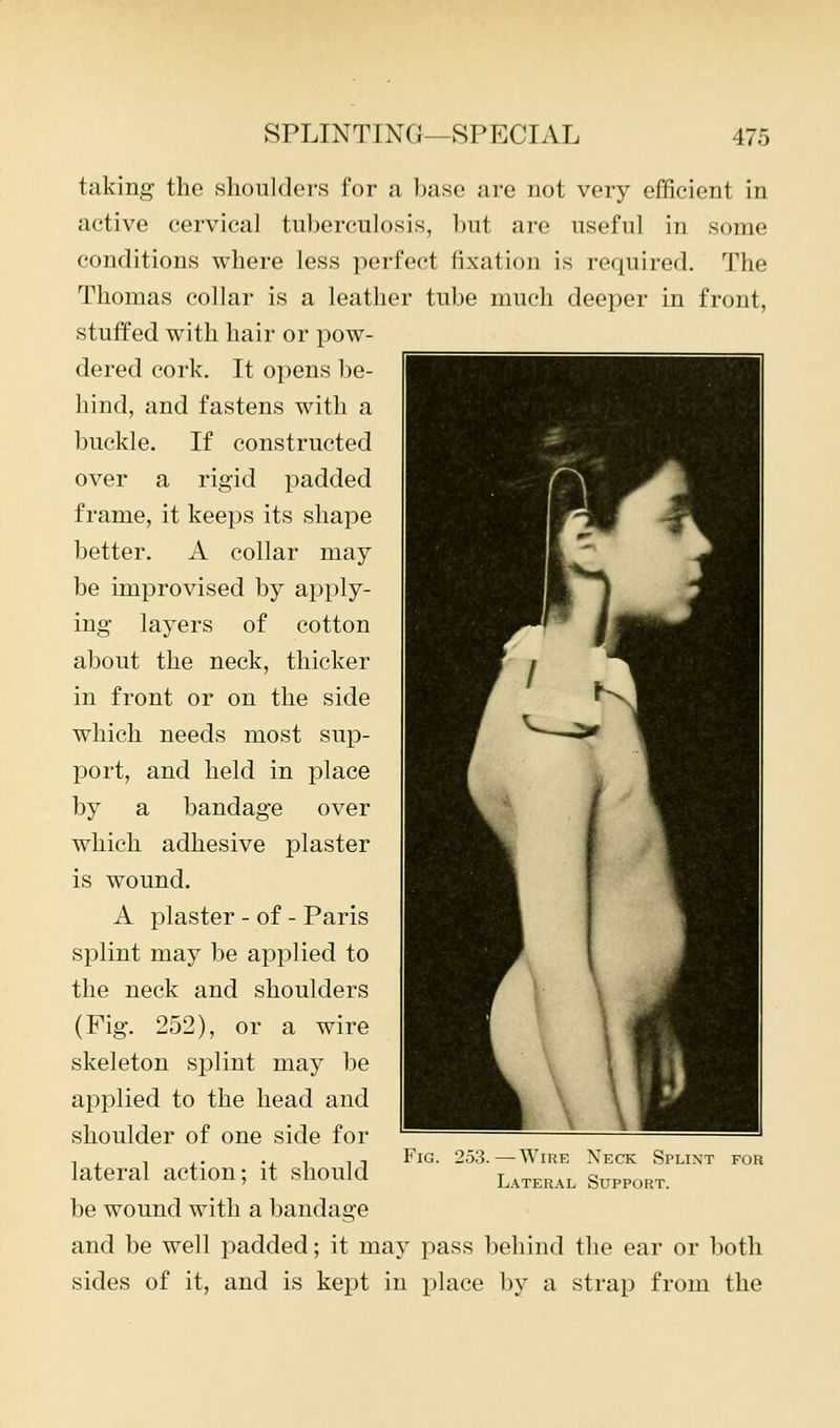 taking the shoulders for a base are not very efficient in active cervical tuberculosis, but are useful in some conditions where less perfect fixation is required. The Thomas collar is a leather tube much deeper in front, stuffed with hair or pow- dered cork. It opens be- hind, and fastens with a buckle. If constructed over a rigid padded frame, it keeps its shape better. A collar may be improvised by apply- ing layers of cotton about the neck, thicker in front or on the side which needs most sup- port, and held in place by a bandage over which adhesive plaster is wound. A plaster - of - Paris splint may be applied to the neck and shoulders (Fig. 252), or a wire skeleton splint may be applied to the head and shoulder of one side for lateral action; it should be wound with a bandage and be well padded; it may pass behind the ear or both sides of it, and is kept in place by a strap from the Fig. 253.—Wire Neck Splint for L.\TERAL Support.
