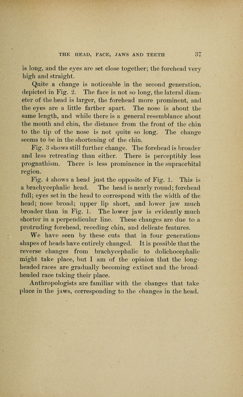is long, and the eyes are set close together; the forehead very high and straight. Quite a change is noticeable in the second generation, depicted in Fig. 2. The face is not so long, the lateral diam- eter of the head is larger, tTie forehead more prominent, and the eyes are a little farther apart. The nose is about the same length, and while there is a general resemblance about the mouth and chin, the distance from the front of the chin to the tip of the nose is not quite so long. The change seems to be in the shortening of the chin. Fig. 3 shows still further change. The forehead is broader and less retreating than either. There is perceptibly less prognathism. There is less prominence in the supraorbital region. Fig. 4 shows a head just the opposite of Fig. 1. This is a brachycephalic head. The head is nearly round; forehead full; eyes set in the head to correspond with the width of the head; nose broad; upper lip short, and lower jaw much broader than in Fig. 1. The lower jaw is evidently much shorter in a perpendicular line. These changes are due to a protruding forehead, receding chin, and delicate features. We have seen by these cuts that in four generations shapes of heads have entirely changed. It is possible that the reverse changes from brachycephalic to dolichocephalic might take place, but I am of the opinion that the long- headed races are gradually becoming extinct and the broad- headed race taking their place. Anthropologists are familiar with the changes that take place in the jaws, corresponding to the changes in the head.