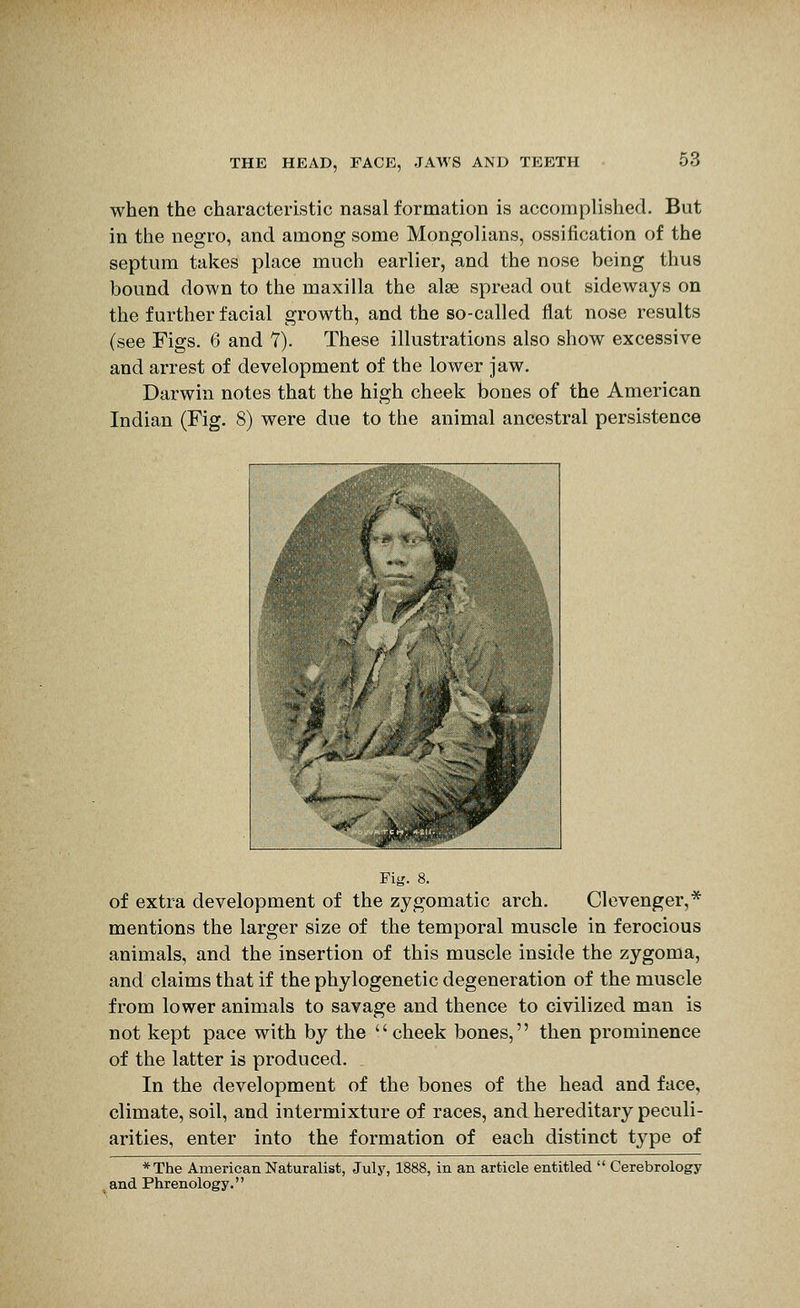 when the characteristic nasal formation is accomplished. But in the negro, and among some Mongolians, ossification of the septum takes place much earlier, and the nose being thus bound down to the maxilla the alee spread out sideways on the further facial growth, and the so-called flat nose results (see Figs. 6 and 7). These illustrations also show excessive and arrest of development of the lower jaw. Darwin notes that the high cheek bones of the American Indian (Fig. 8) were due to the animal ancestral persistence Fig. 8. of extra development of the zygomatic arch. Clevenger,* mentions the larger size of the temporal muscle in ferocious animals, and the insertion of this muscle inside the zygoma, and claims that if the phylogenetic degeneration of the muscle from lower animals to savage and thence to civilized man is not kept pace with by the cheek bones, then prominence of the latter is produced. In the development of the bones of the head and face, climate, soil, and intermixture of races, and hereditary peculi- arities, enter into the formation of each distinct type of *The American Naturalist, July, 1888, in an article entitled  Cerebrology . and Phrenology.