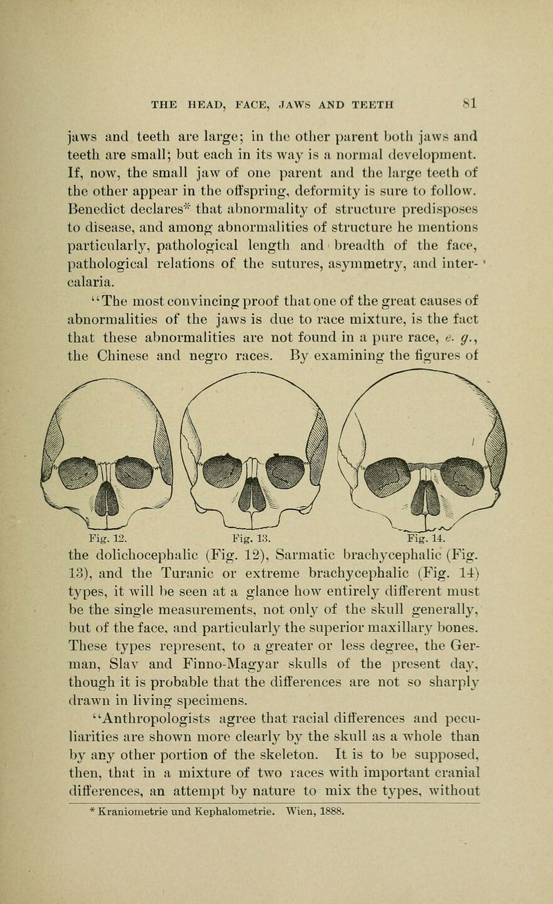 SI jaws and teeth are large; in the other parent both jaws and teeth are small; but each in its way is a normal development. If, now, the small jaw of one parent and the large teeth of the other appear in the offspring, deformity is sure to follow. Benedict declares* that abnormality of structure predisposes to disease, and among abnormalities of structure he mentions particularly, pathological length and breadth of the face, pathological relations of the sutures, asymmetry, and inter- calaria. The most convincing proof that one of the great causes of abnormalities of the jaws is due to race mixture, is the fact that these abnormalities are not found in a pure race, e. g.^ the Chinese and negro races. By examining the figures of Fig. 12. Fig. 13. Fig. 14. the dolichocephalic (Fig. 12), Sarmatic brachycephalic (Fig. 13), and the Turanic or extreme brachycephalic (Fig. 14) types, it will be seen at a glance how entirely different must be the single measurements, not only of the skull generally, but of the face, and particularly the superior maxillary bones. These types represent, to a greater or less degree, the Ger- man, Slav and Finno-Magyar skulls of the present day, though it is probable that the differences are not so sharply drawn in living specimens. Anthropologists agree that racial differences and pecu- liarities are shown more clearly by the skull as a whole than by any other portion of the skeleton. It is to be supposed, then, that in a mixture of two races with important cranial differences, an attempt by nature to mix the types, without * Kraniometrie und Kephalometrie. Wien, 1888.