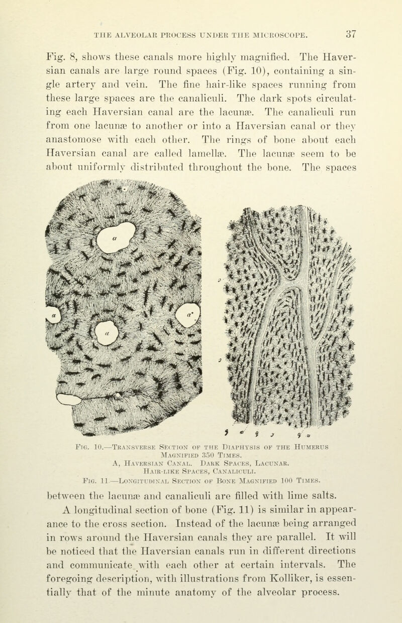 Fig. 8, shows these canals more highly magnified. The Haver- sian canals are large romid spaces (Fig. 10), containing a sin- gle artery and vein. The fine hair-like spaces running from these large spaces are the canalicnli. The dark spots circulat- ing each Haversian canal are the lacunae. The canalicnli run from one lacunae to another or into a Haversian canal or they anastomose with each other. The rings of bone about each Haversian canal are called lamella. The lacuna' seem to be about uniformly distributed throughout the bone. The spaces -^ -^■ ^,^''** ^/V^*' ■^ Fjg. 10.—Transverse Section of the Diaphysis of the Humerus Magnified 350 Times. A, Haversian Canal. Dark Spaces, Lacunar. Hair-like Spaces, Canaliculi. Fig. 11.—Longitudinal Section of Bone Magnified 100 Times. between the lacunae and canaliculi are filled with lime salts. A longitudinal section of bone (Fig. 11) is similar in appear- ance to the cross section. Instead of the lacunae being arranged in rows around the Haversian canals they are parallel. It will be noticed that the Haversian canals run in different directions and communicate ^\ith each other at certain intervals. The foregoing description, with illustrations from Kolliker, is essen- tially that of the minute anatomy of the alveolar process.