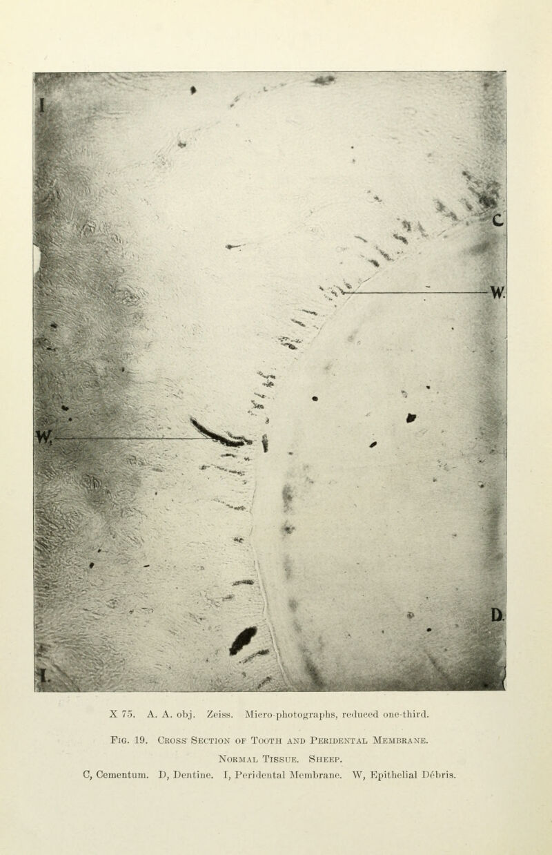 ■^*p \:h^ W. %• X 75. A. A. obj. Zeiss. Alicro-pbotugraphs, ru<luecd one-third. D Fig. 19. Cross Section of Tooth and Peridental Membrane. Normal Tissue. Sheep. C, Cementum. D, Dentine. I, Peridental Membrane. W, Epithelial Debris