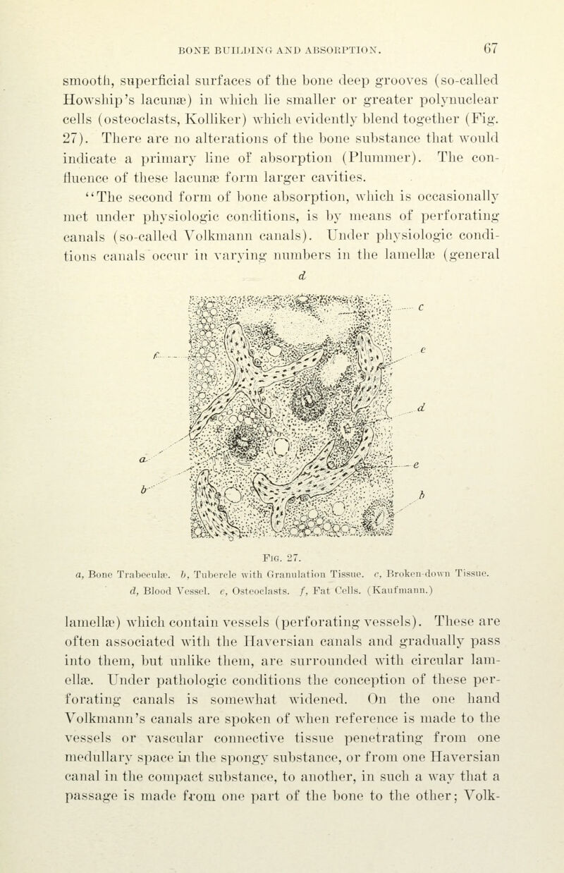 smooth, superficial surfaces of the bone deep grooves (so-called Howship's lacunae) in which lie smaller or greater polynuclear cells (osteoclasts, Kolliker) which evidently blend together (Fig. 27). There are no alterations of the bone substance that would indicate a primary line of absorption (Plummer). The con- fluence of these lacunae form larger cavities. ''The second form of bone absorption, which is occasionally met under physiologic conditions, is by means of perforating canals (so-called Volkmann canals). Under physiologic condi- tions canals occur in varying numbers in tlie lamellae (general Fig. 27. a, Bone Trabeevila'. h, Tubercle with Granulation Tissue, c. Broken-down Tissue. d, Blood Vessel, e, Osteoclasts. /, Fat Cells. (Kaufmann.) lamellae) which contain vessels (perforating vessels). These are often associated with the Haversian canals and gradually pass into them, but unlike them, are surrounded with circular lam- ellae. Under pathologic conditions the conception of these per- forating canals is somewhat widened. On the one hand Volkmann's canals are spoken of when reference is made to the vessels or vascular connective tissue penetrating from one medullary space in the spongy substance, or from one Haversian canal in the compact substance, to another, in such a way that a passage is made from one part of the bone to the other; Volk-