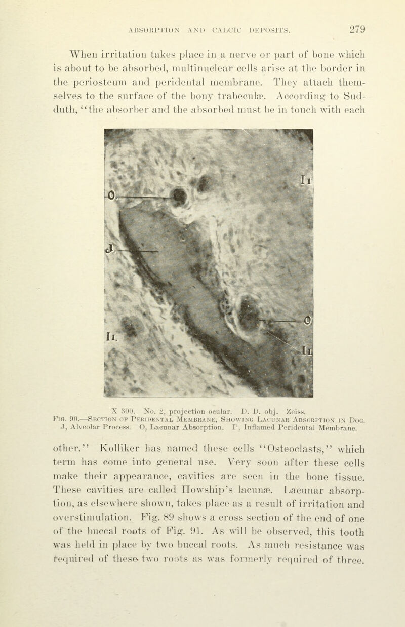 When irritation takes place in a nerve or part of bone wliicli is about to be a])sorbed, niultiniiclear cells arise at the border in the periosteum and jjeridental membrane. They attach them- selves to the surface of the bony trabecule^, xlccording to Sud- dutii, ^'the absorber and the absorbed must be in touch with each X 300. No. 2, projection ocular. D. I), obj. Zeiss. Fir,. 90.—Section of Peridextal Membrane, Showing Lacunar Absorption in Dog. J, Alveolar Process. O, Lacunar Absorption. I^, Inflamed Peridental Membrane. other. Kolliker has named these cells ''Osteoclasts, which term has come into general use. Very soon after these cells make their appearance, cavities are seen in the bone tissue. These cavities are called Howship's lacunae. Lacunar absorp- tion, as elsewhere shown, takes place as a result of irritation and overstinnilation. Fig. cS9 shows a cross section of the end of one of the buccal roots of Fig. 91. As will be observed, this tooth was held in place by two buccal roots. As much resistance was h'(|iiii-(Ml of tliese. two I'oots as was formerly required of three.