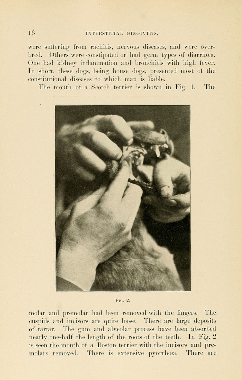 were suffering from rachitis, nervous diseases, and were over- bred. Others were constipated or had germ tyj)es of diarrhoea. One had kidney inflammation and bronchitis with high fever. In short, these dogs, being house dogs, presented most of the constitutional diseases to which man is liable. The month of a Scotch terrier is shown in Fm, 1. The molar and premolar had been removed with the fingers. The cuspids and incisors are quite loose. There are large deposits of tartar. The gum and alveolar process have been absorbed nearly one-half the length of the roots of the teeth. In Fig. 2 is seen the mouth of a Boston terrier with the incisors and j^re- molars removed. There is extensive pyorrhoea. There are