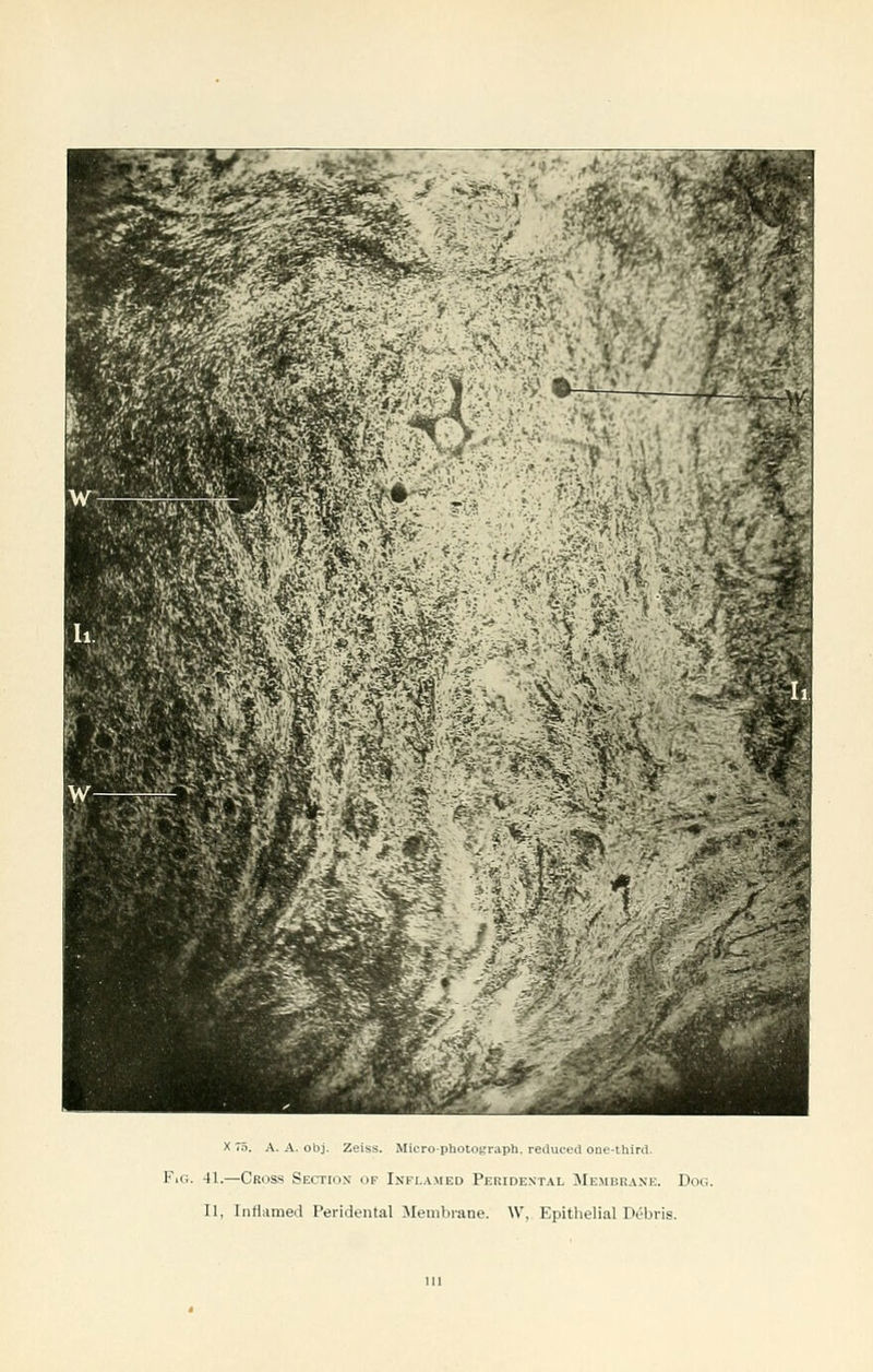 FiG. 41.—Cross SEcrroN op Inflamed Peridental Membrane. Dog. II, Inflamed Peridental 3Ienibi-ane. W, Epithelial Debris.