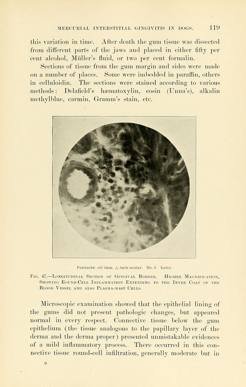 this variation in time. After death the gum tissue was dissected from different parts of the jaws and phxced in either fifty per cent alcohol, Miiller's fluid, or two per cent formalin. Sections of tissue from the gum margin and sides were made on a number of places. Some were imbedded in paraffin, others in celluloidin. The sections were stained according to various methods: Delafield's hsematoxylin, eosin (Unna's), alkalin methylblue, carmin, Gramm's stain, etc. Fantaclir. oil imm. i\ inch ocular. No. :i. Leitz. Fig. 47.—Longitudinal Section of Gingivat, Boedek. Higher Magnification, Showing Round-Cell Inflammation Extending to the Inner Coat of the Blood Vessel and also Plasma-mast Cells. Microscopic examination showed that the epithelial lining of the gums did not present pathologic changes, but appeared normal in every respect. Connective tissue below the gum epithelium (the tissue analogous to the papillary layer of the derma and the derma proper) presented unmistakable evidences of a mild inflammatory process. There occurred in this con- nective tissue round-cell infiltration, oenerallv moderate l)ut in